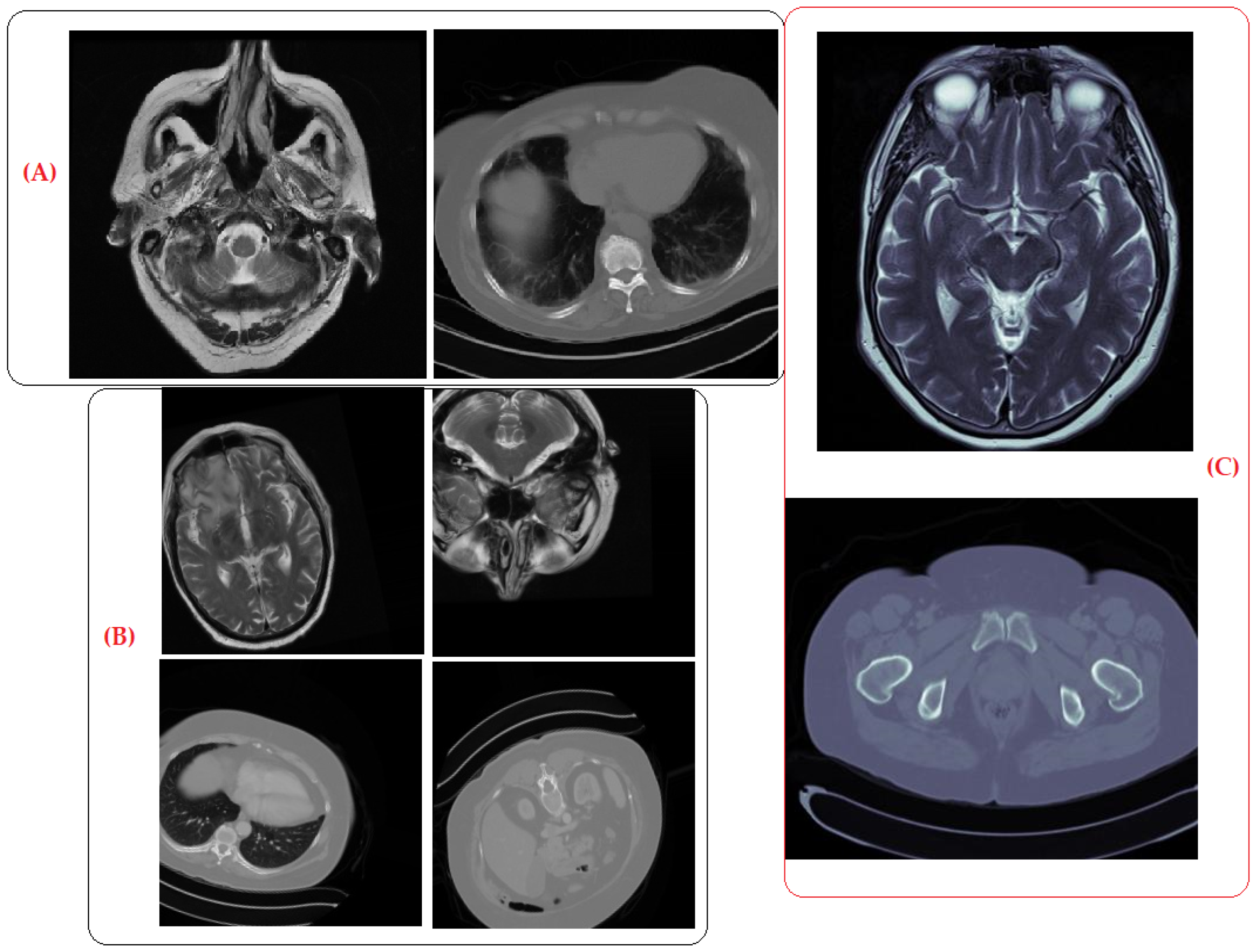 Brainsci 14 00559 g010