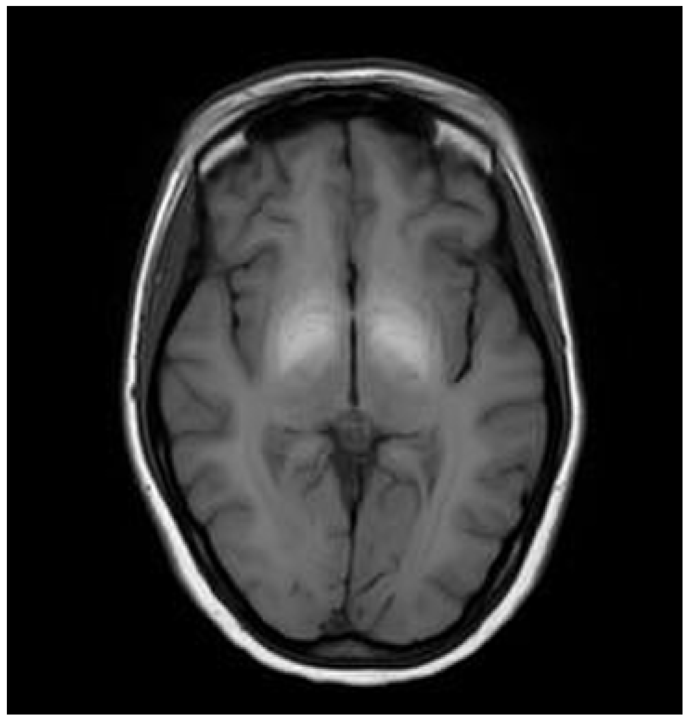 Brainsci 14 00727 g004 Brainsci 14 00727 g004