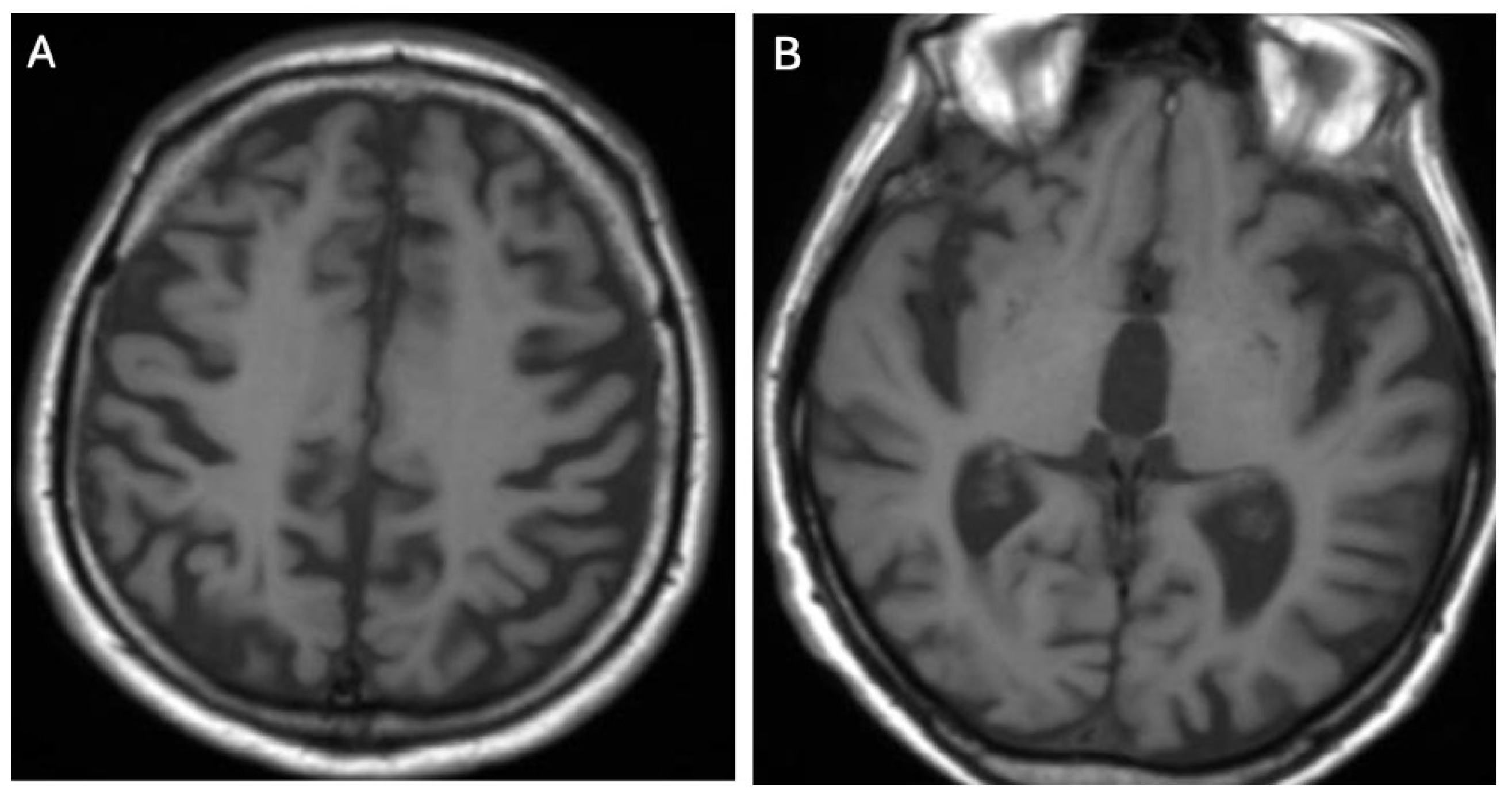 Brainsci 14 00727 g006 Brainsci 14 00727 g006