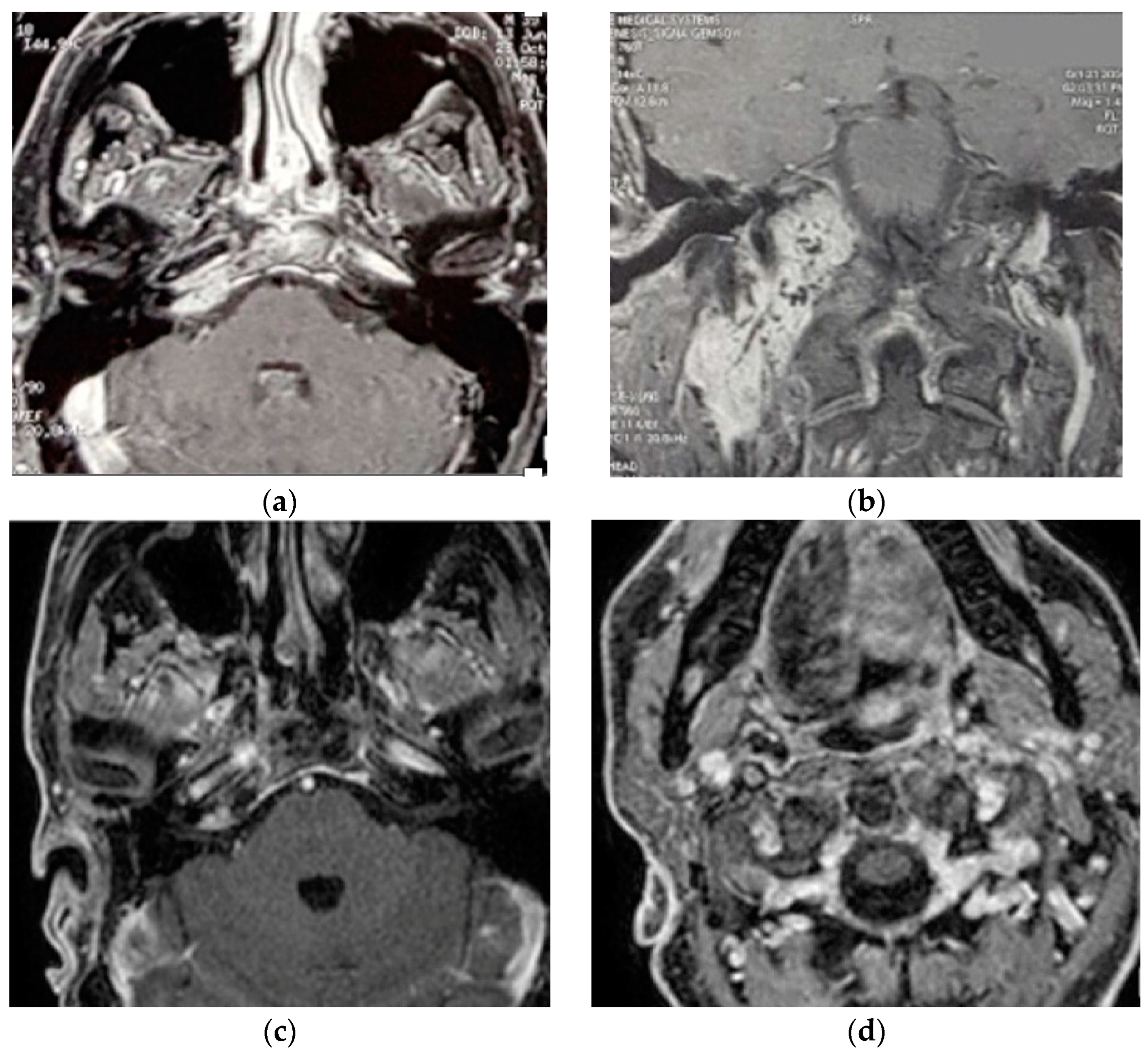 Brainsci 14 00745 g002