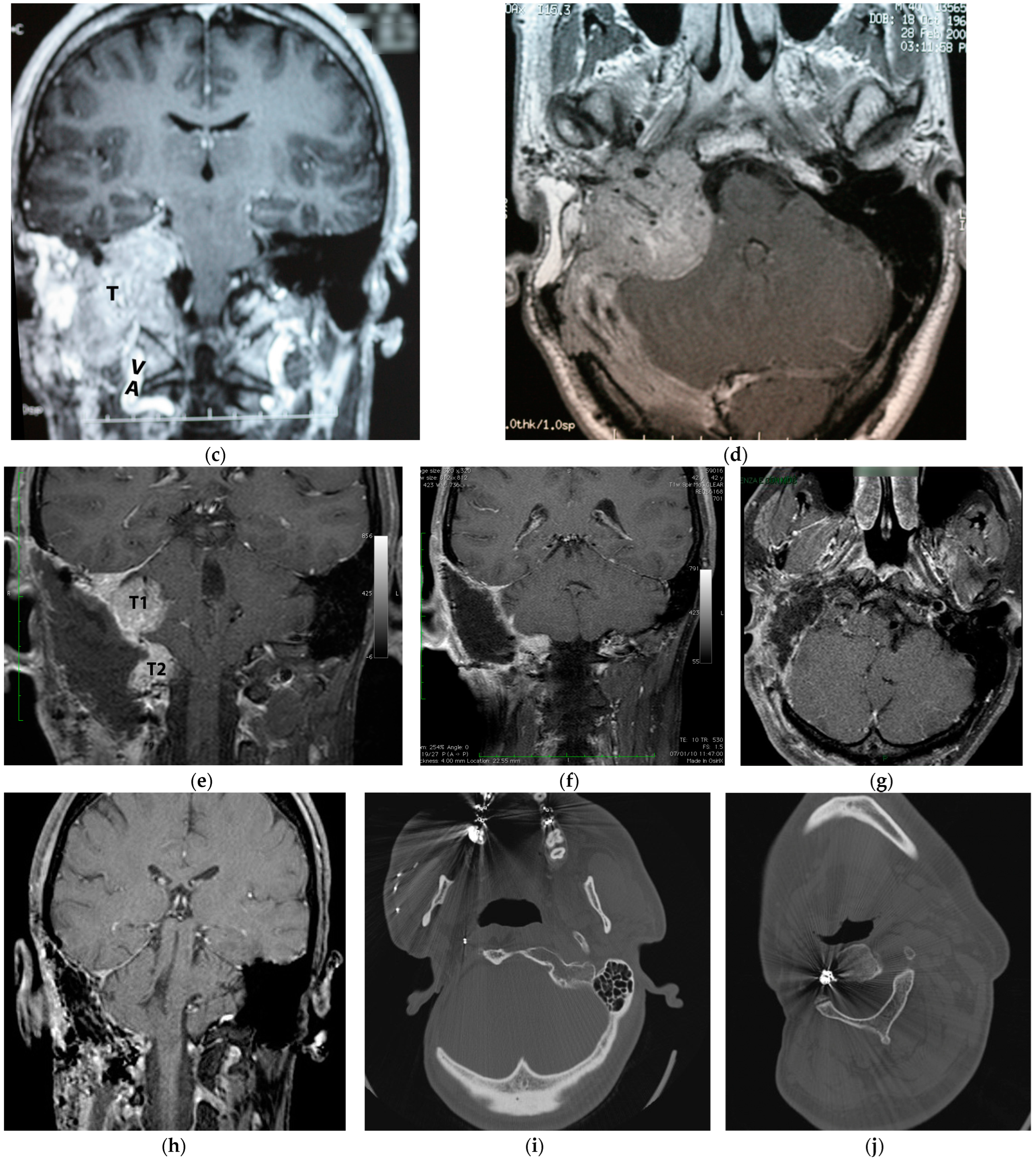 Brainsci 14 00745 g005b