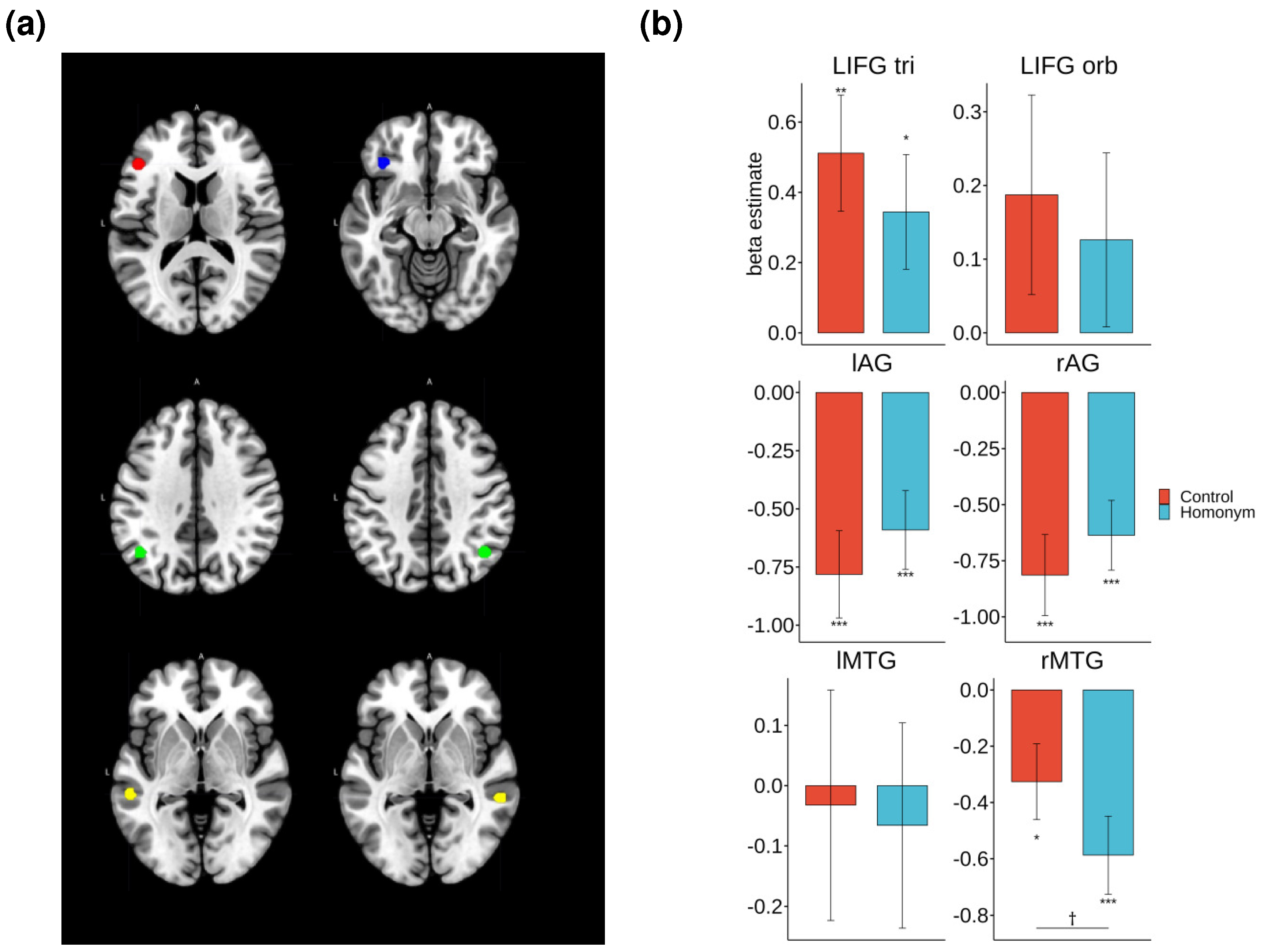 Brainsci 14 00752 g006