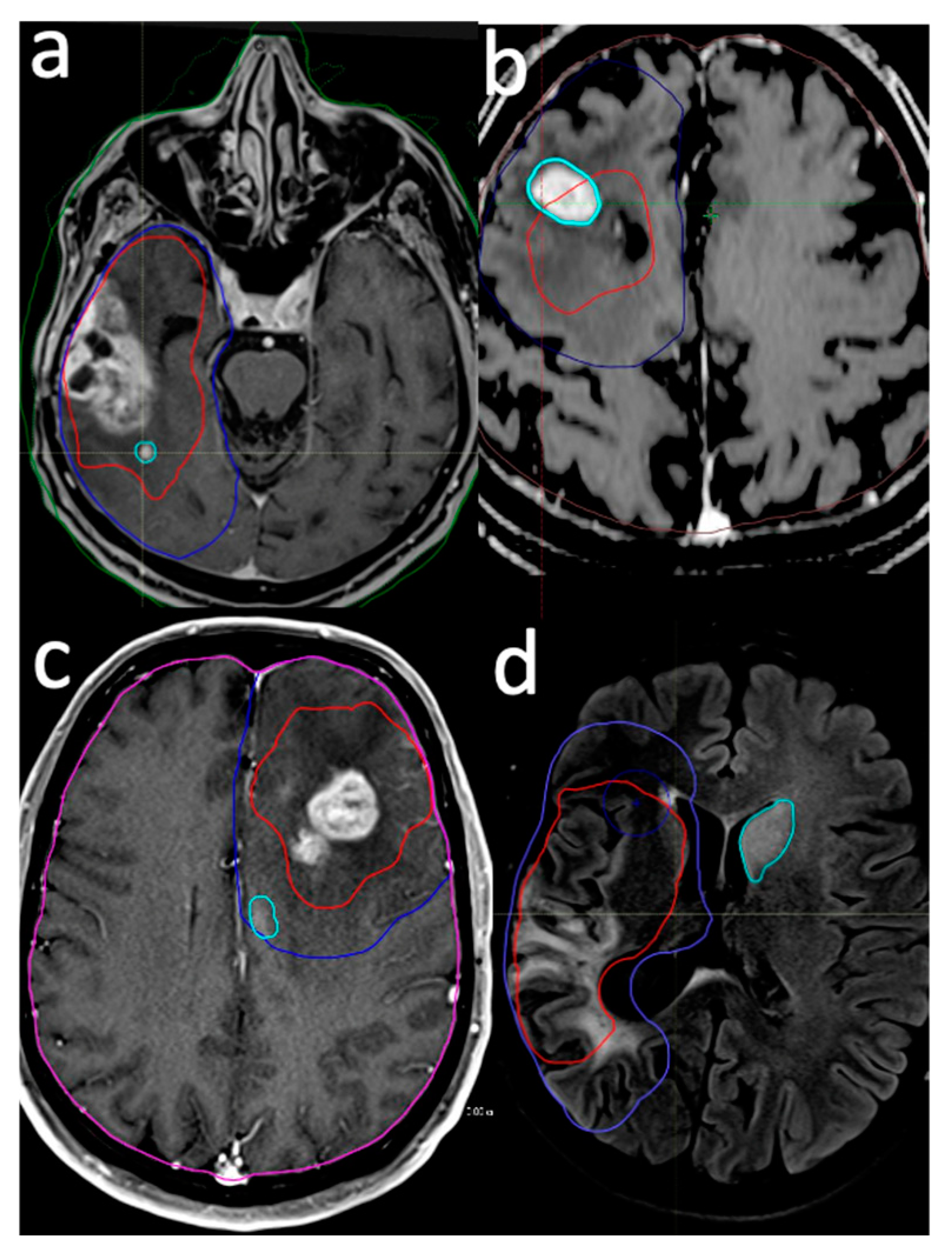 Brainsci 14 00922 g001