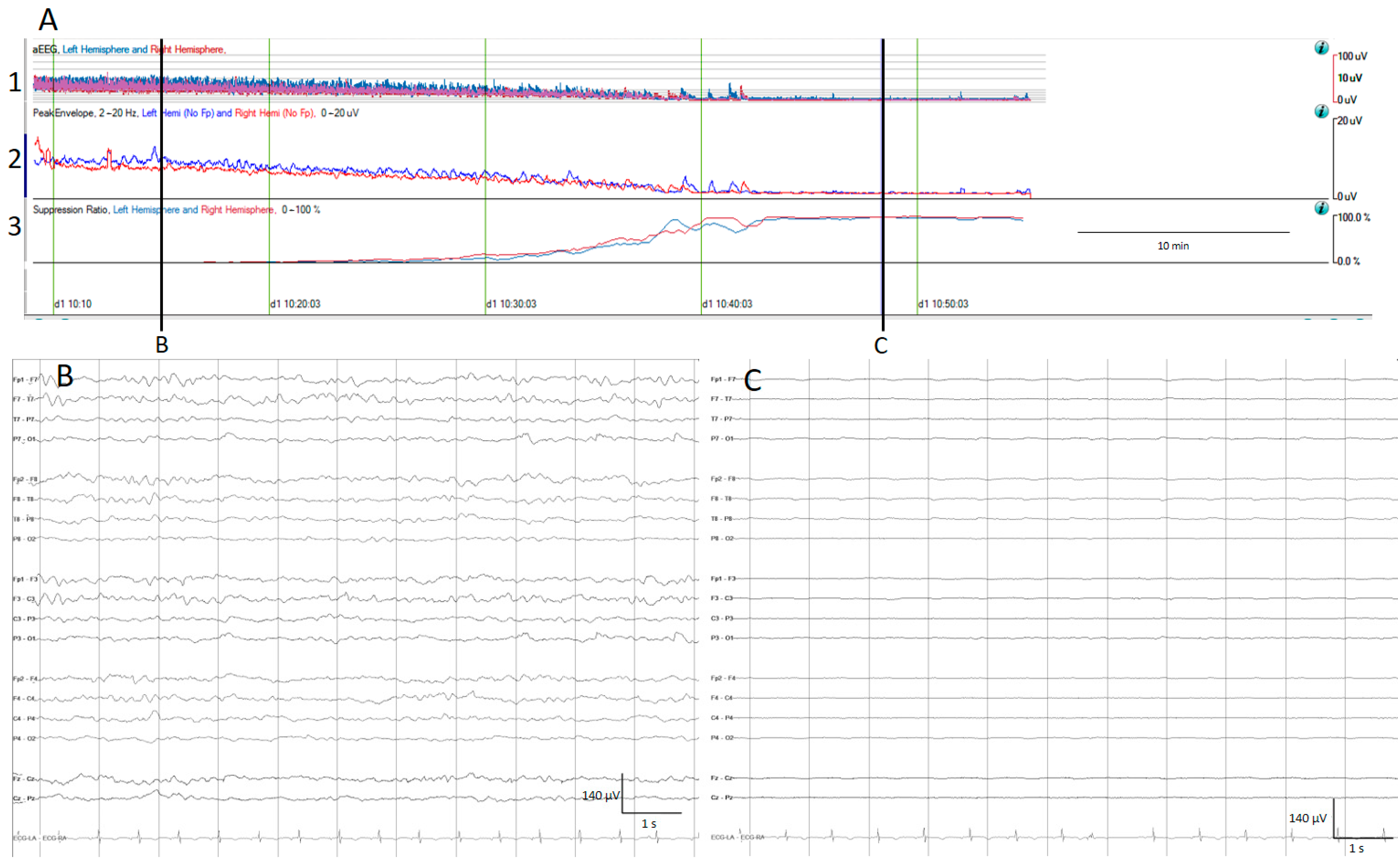 Brainsci 14 00939 g001