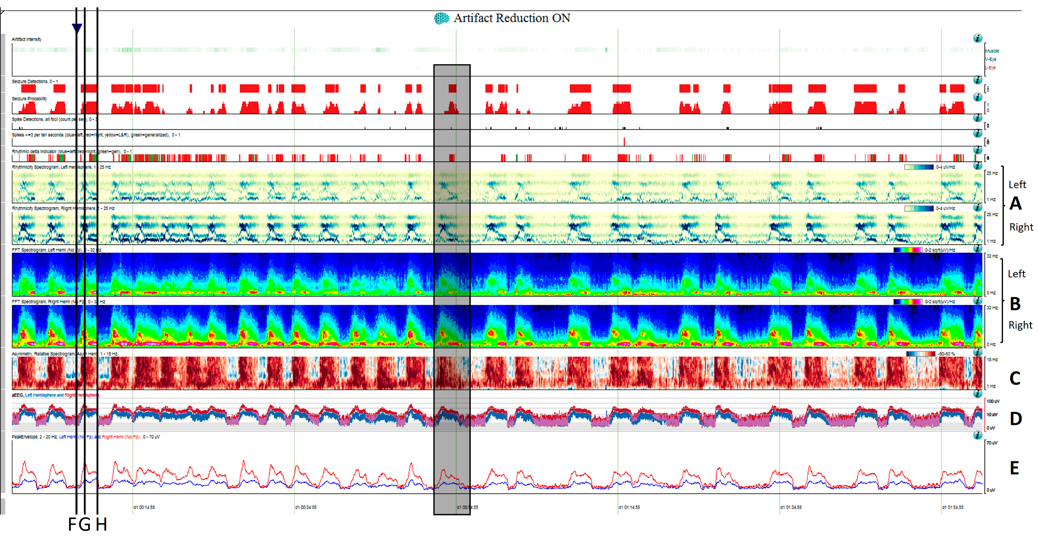 Brainsci 14 00939 g005a