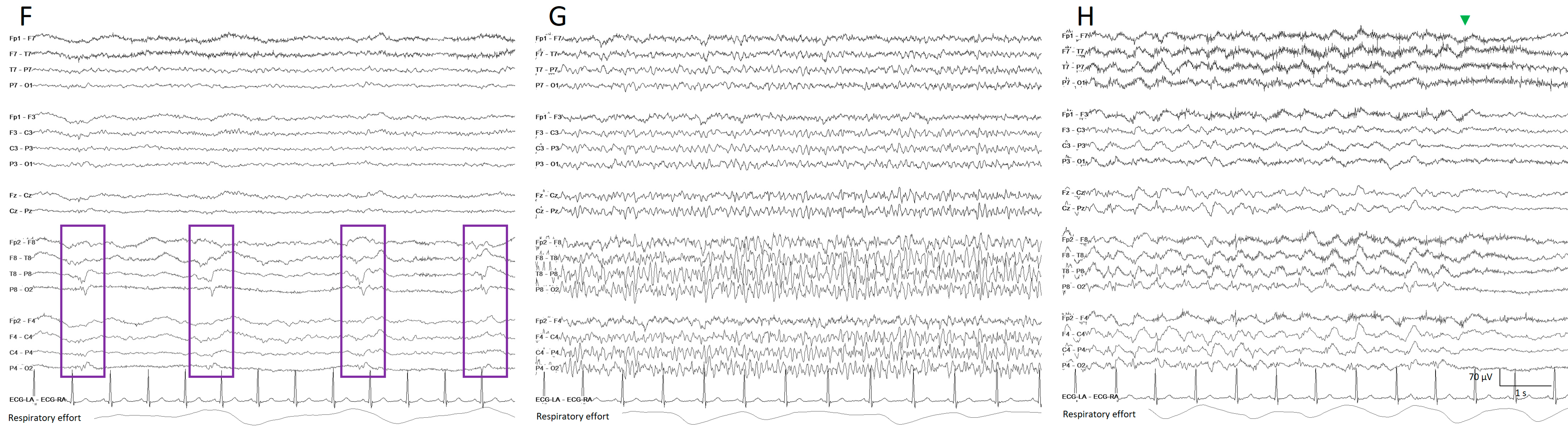 Brainsci 14 00939 g005b