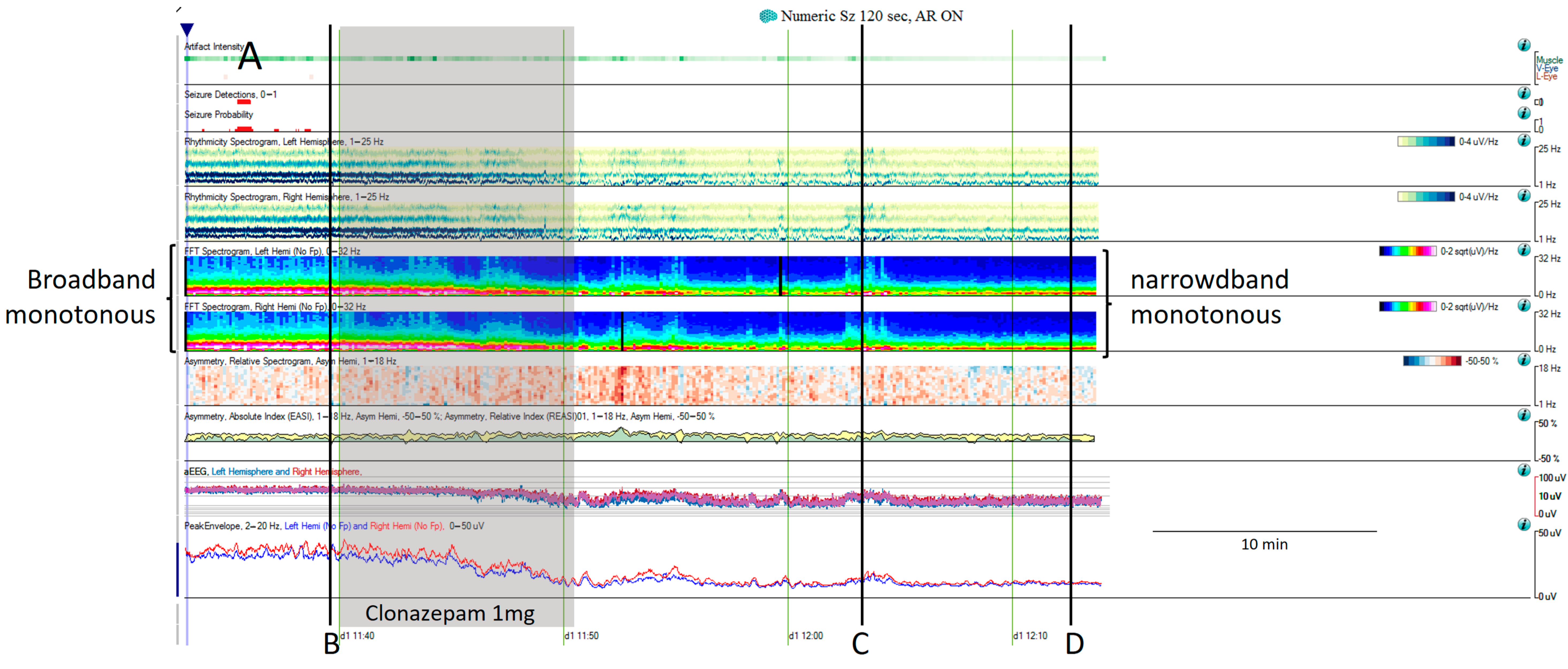Brainsci 14 00939 g006a