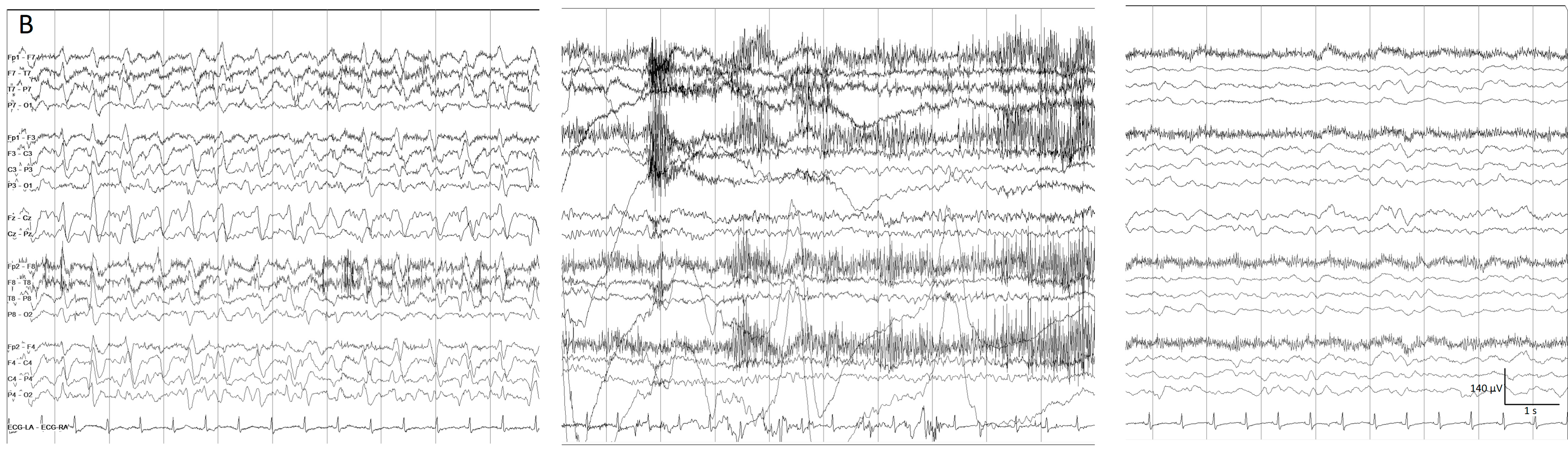 Brainsci 14 00939 g006b