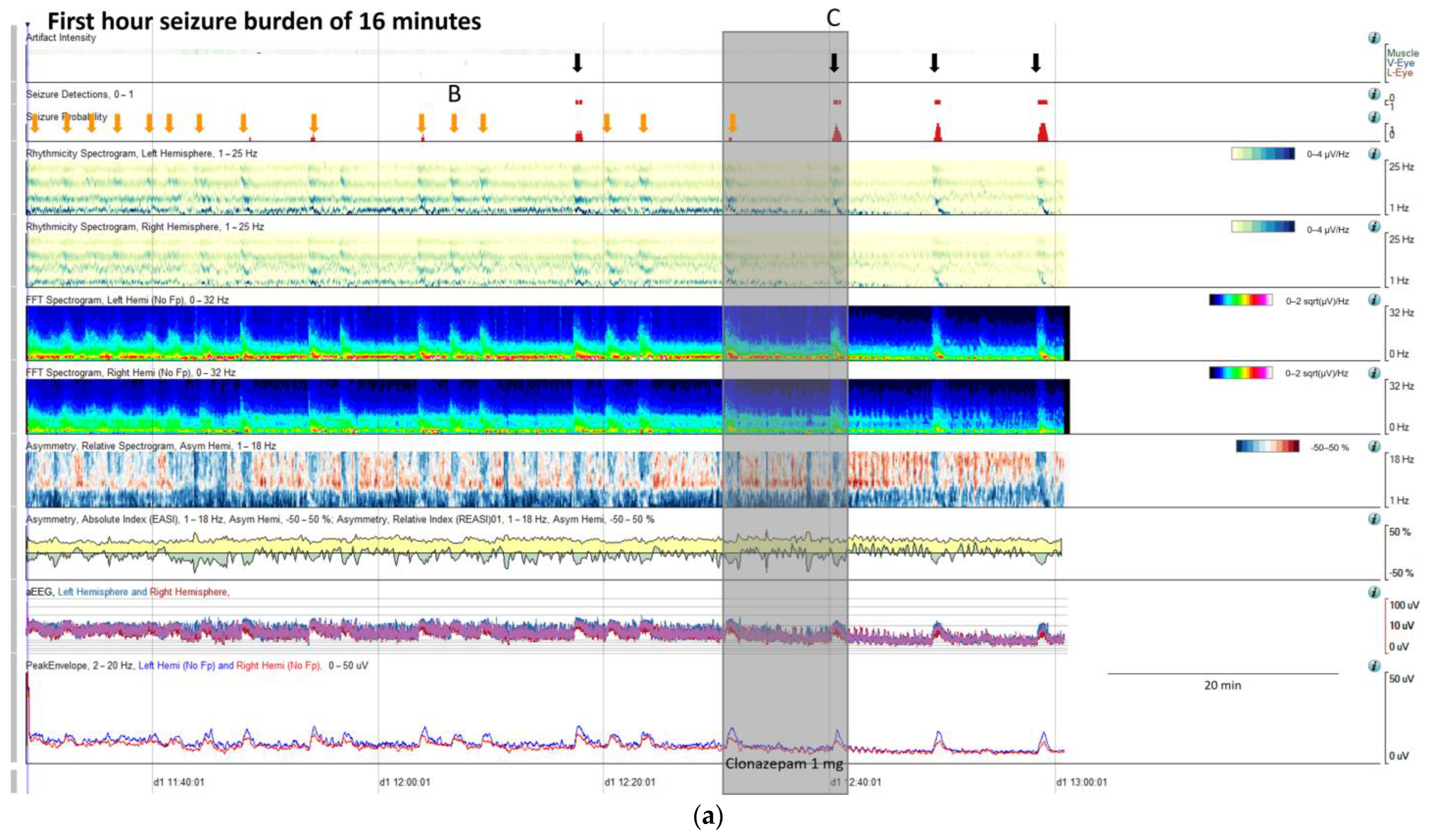 Brainsci 14 00939 g009a