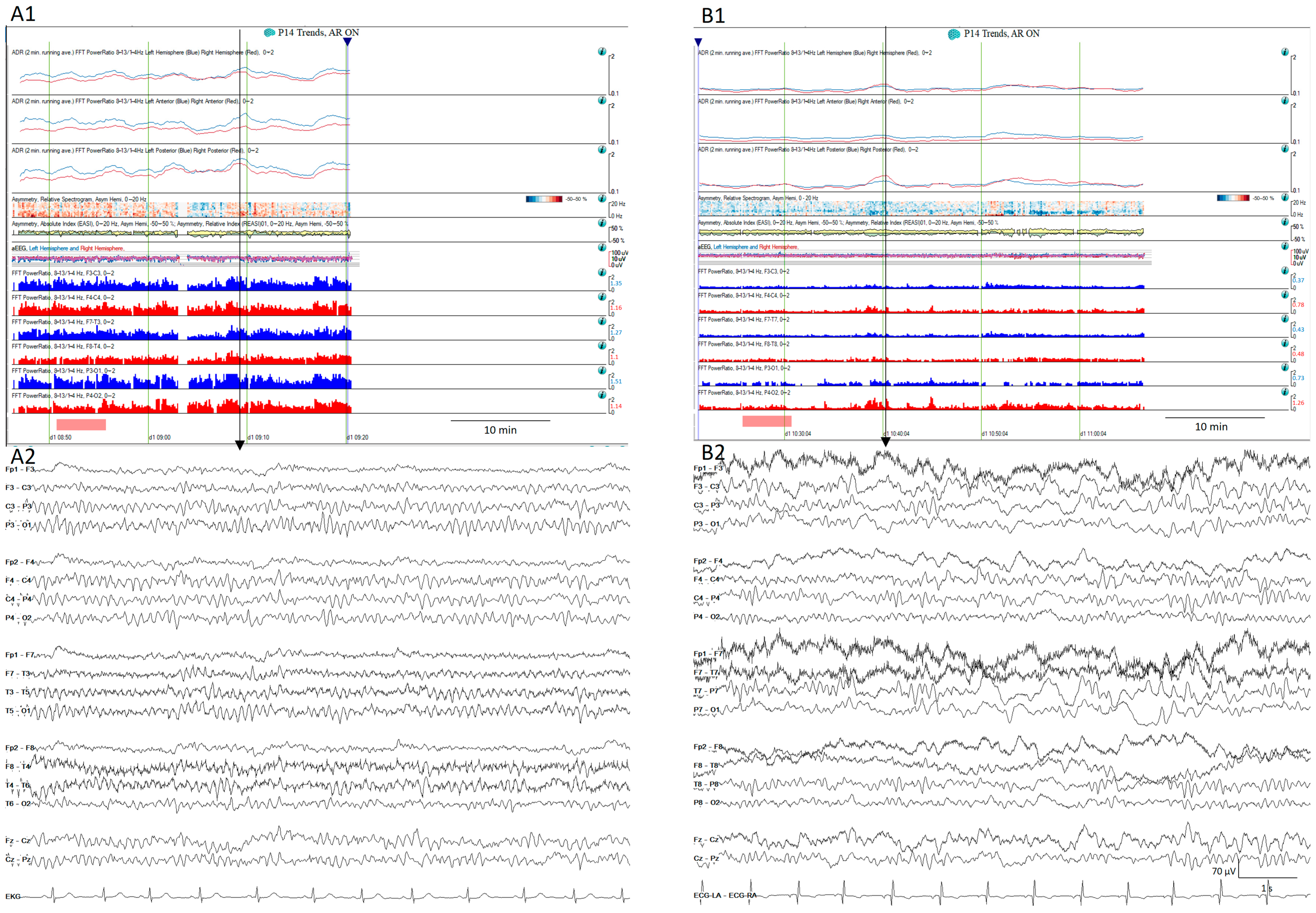 Brainsci 14 00939 g011