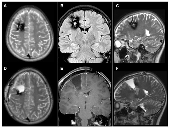 Brainsci 14 00958 g002