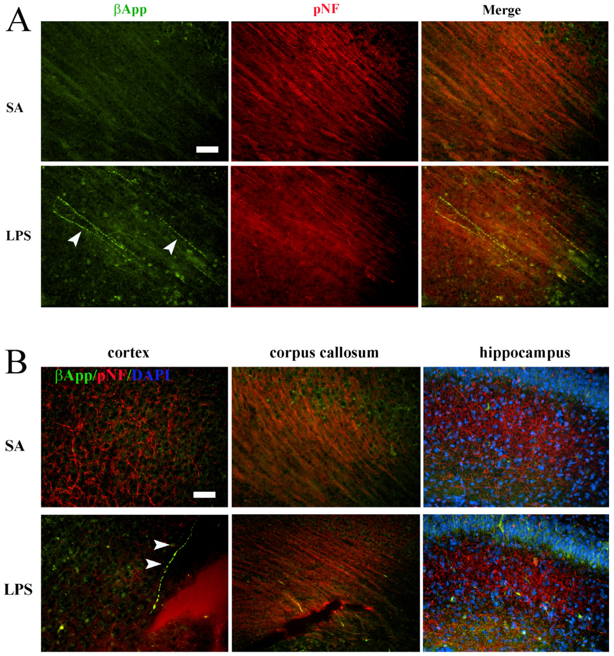 Brainsci 14 00976 g006 Brainsci 14 00976 g006
