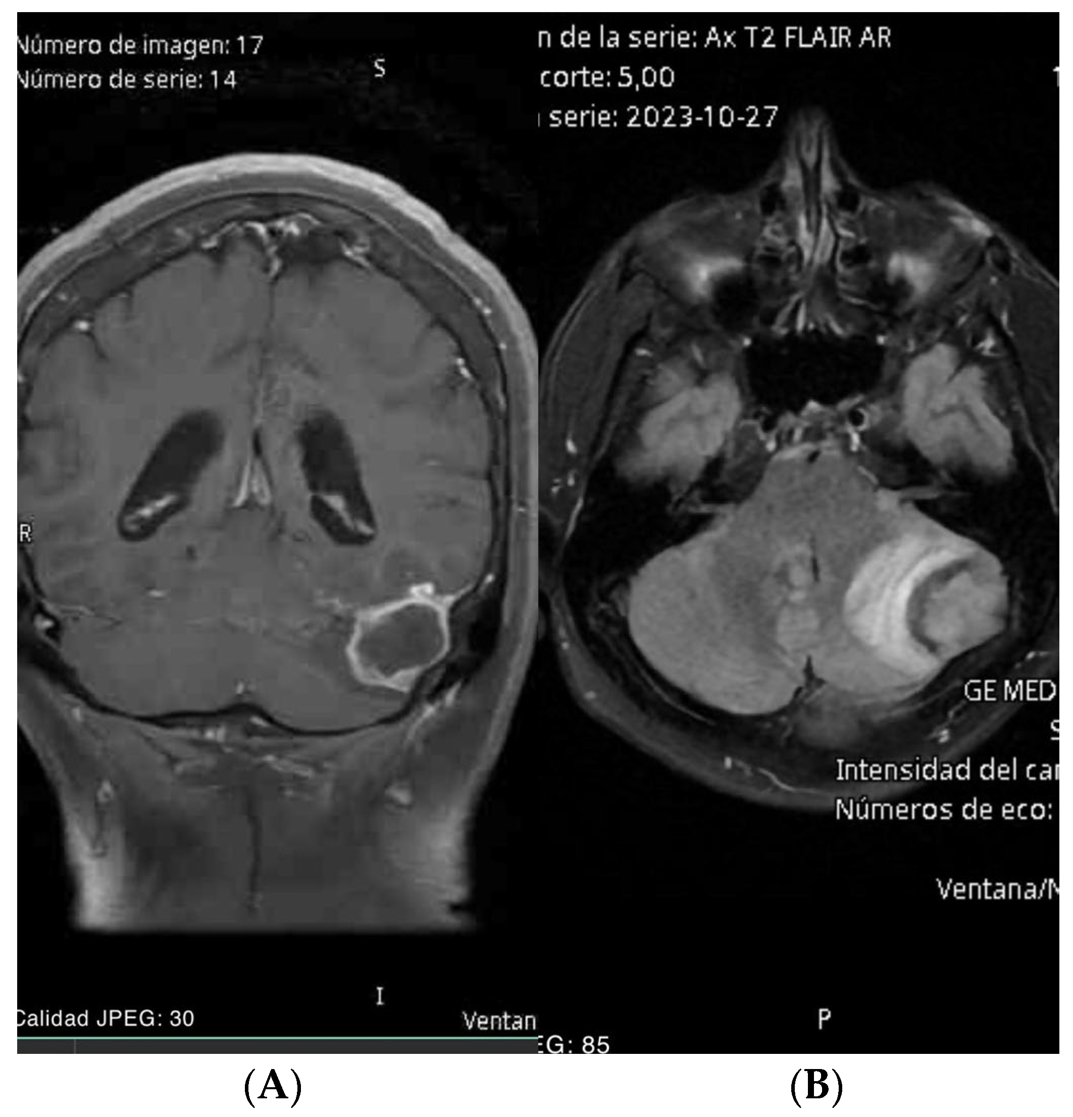 Brainsci 14 01025 g001 Brainsci 14 01025 g001