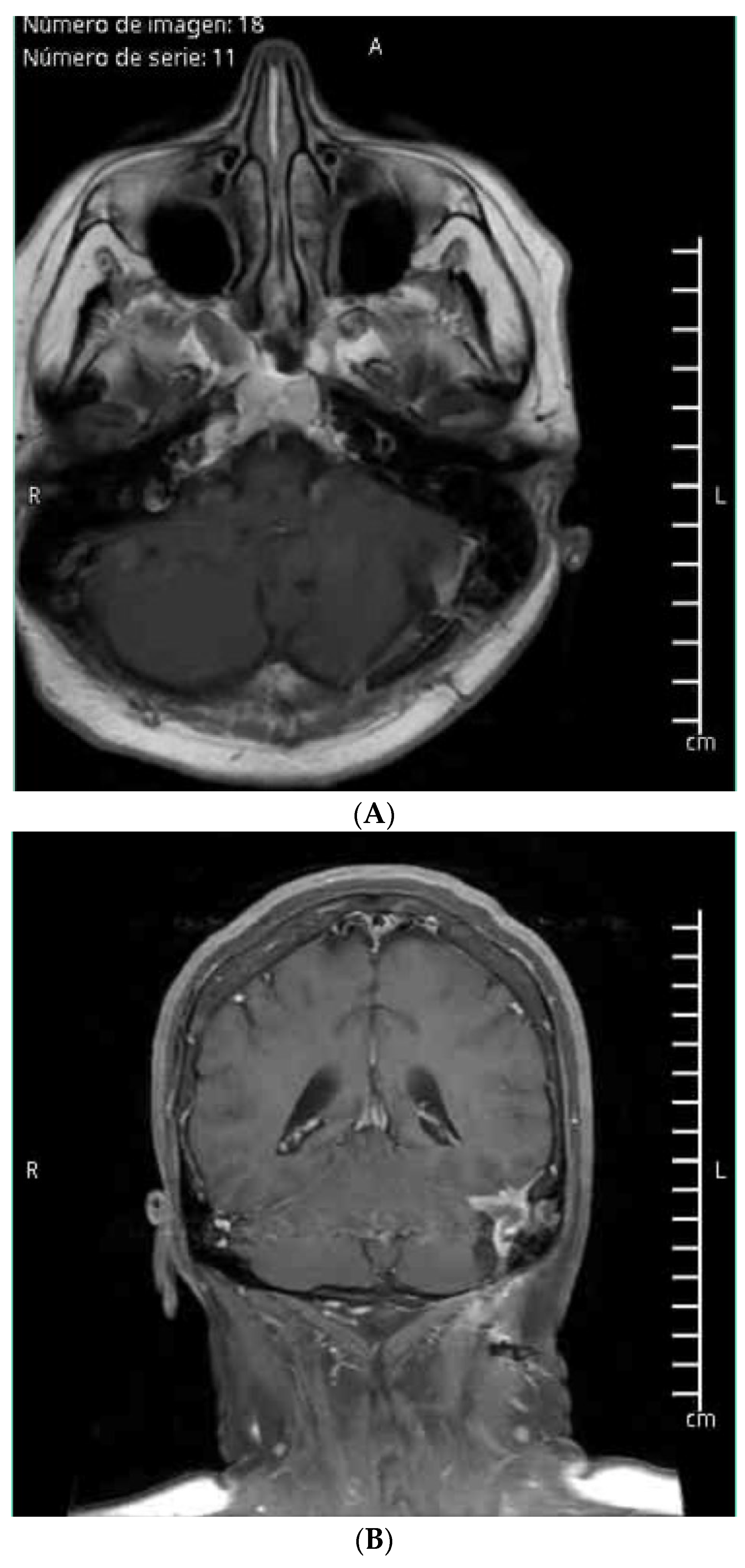 Brainsci 14 01025 g003 Brainsci 14 01025 g003
