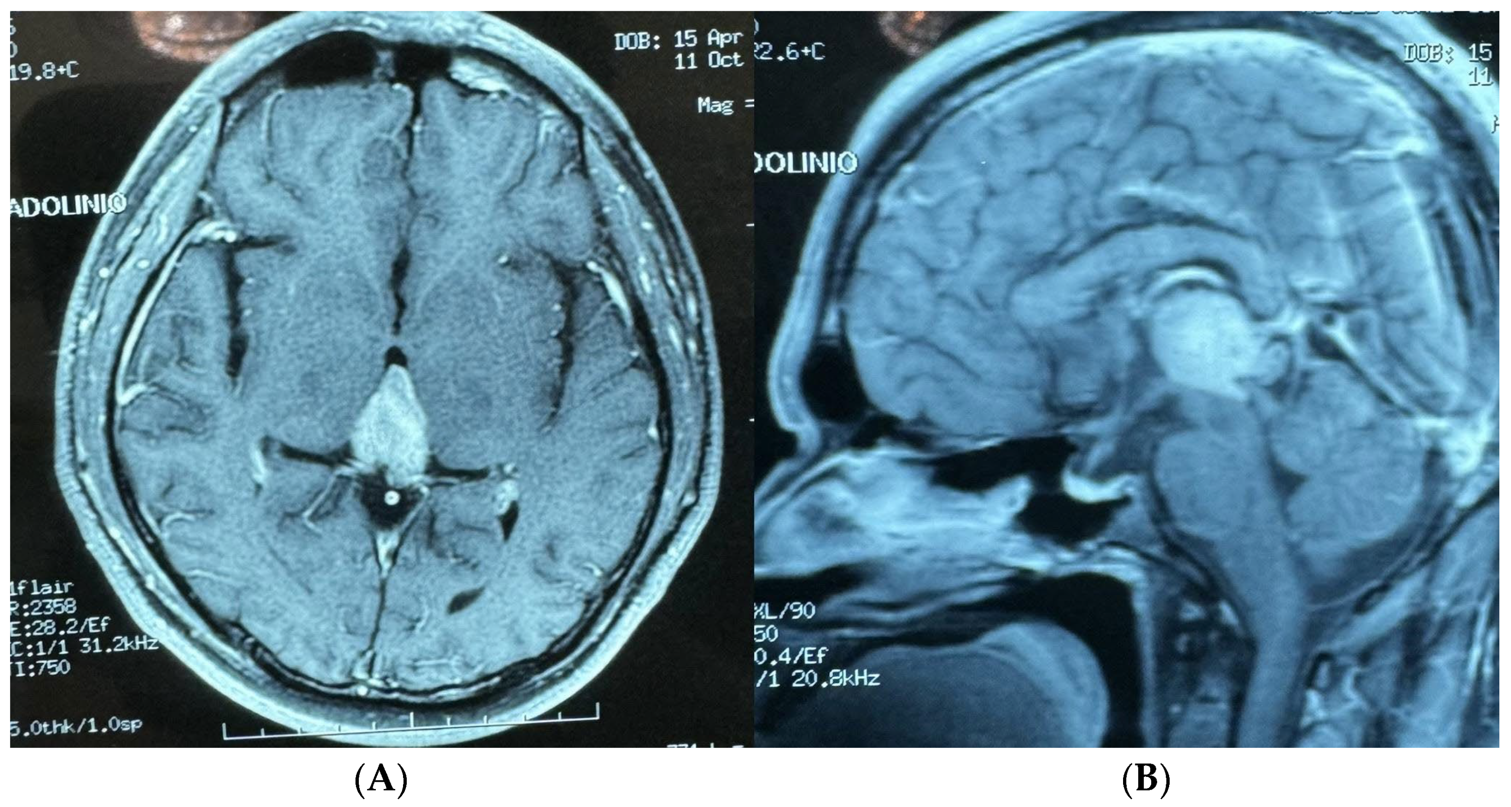 Brainsci 14 01025 g004 Brainsci 14 01025 g004