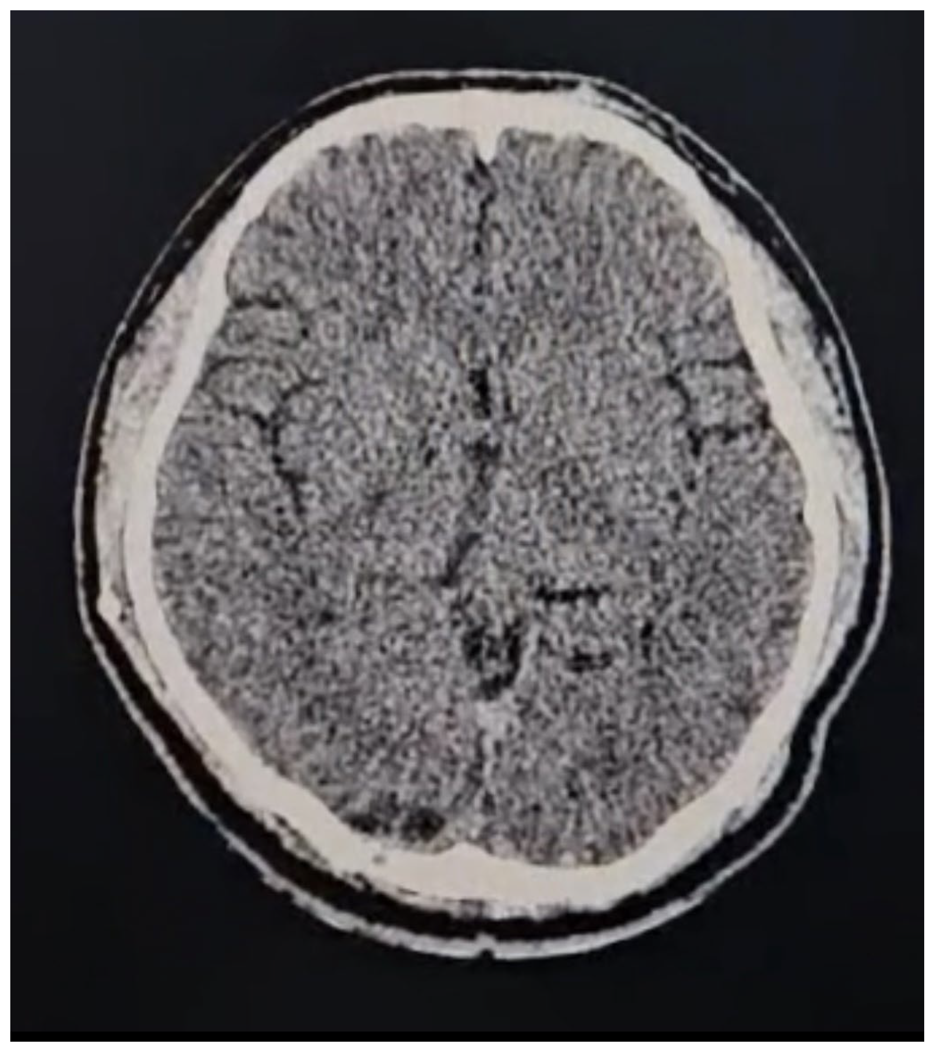 Brainsci 14 01025 g006 Brainsci 14 01025 g006