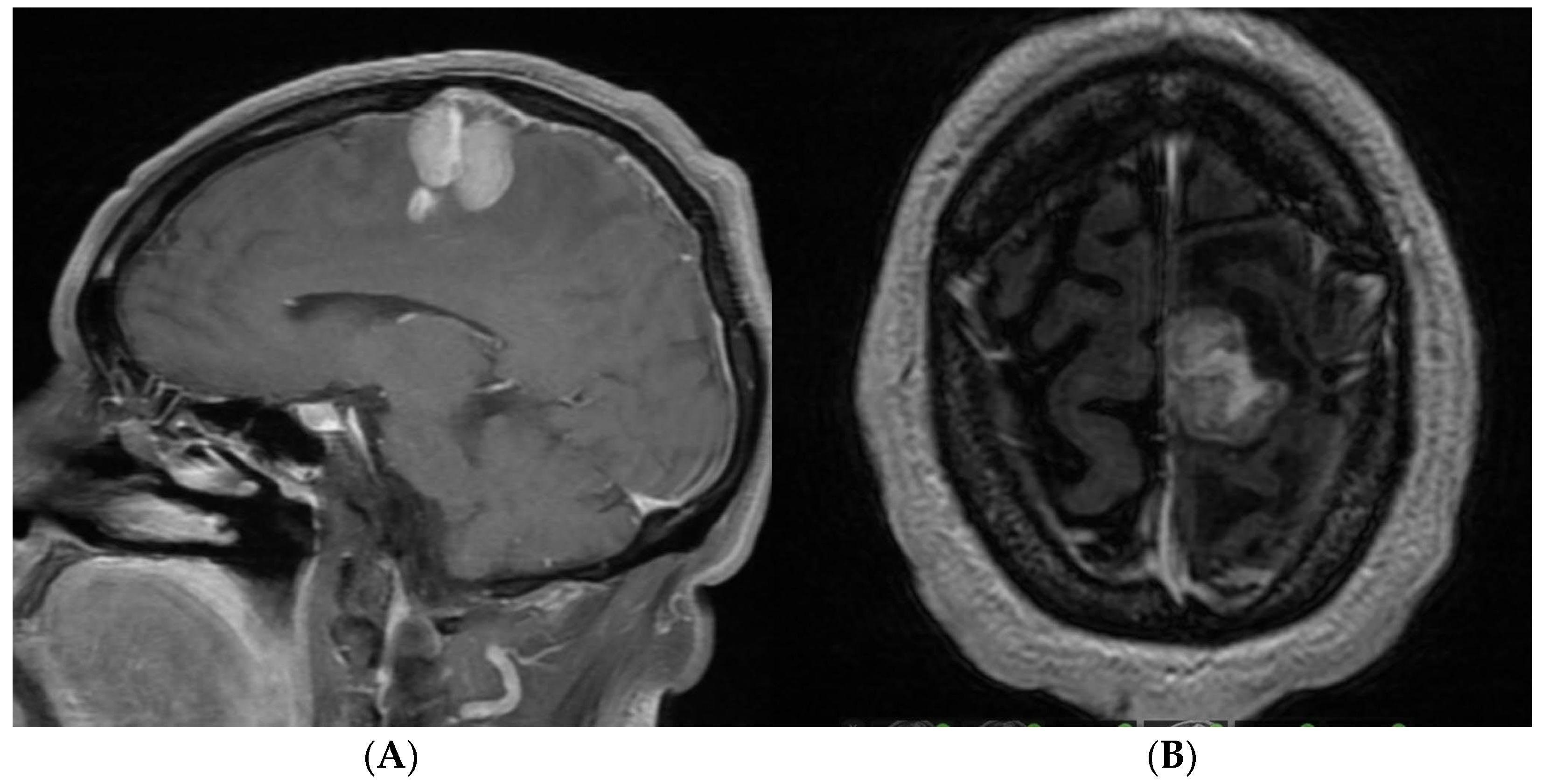 Brainsci 14 01025 g007 Brainsci 14 01025 g007