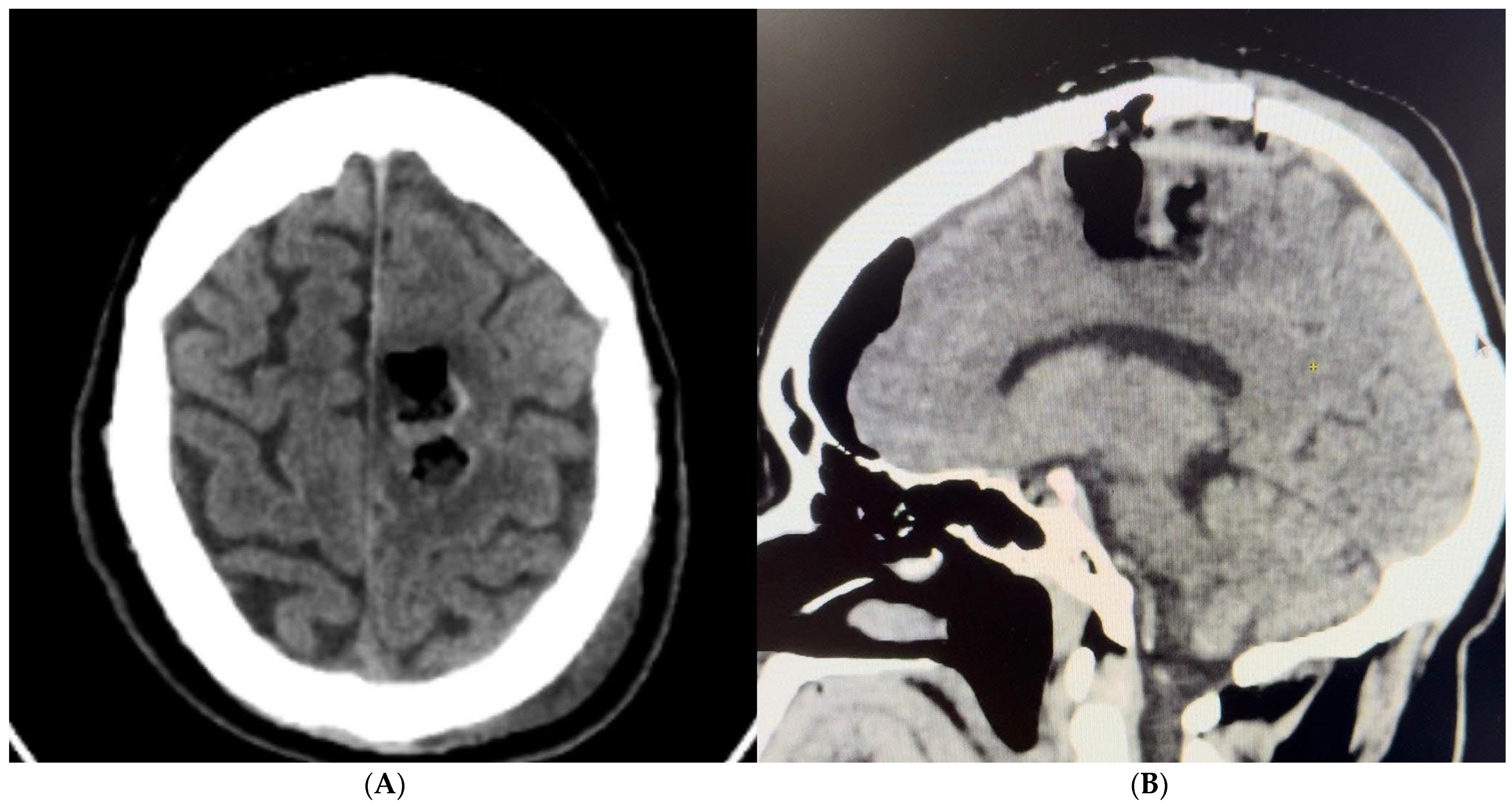 Brainsci 14 01025 g009 Brainsci 14 01025 g009