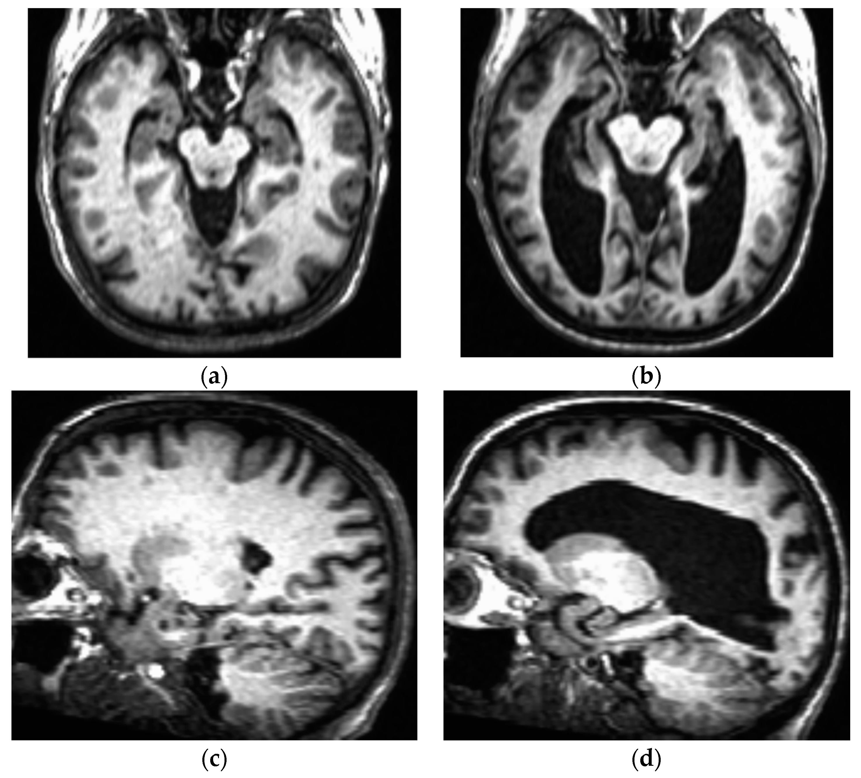 Brainsci 14 01084 g002