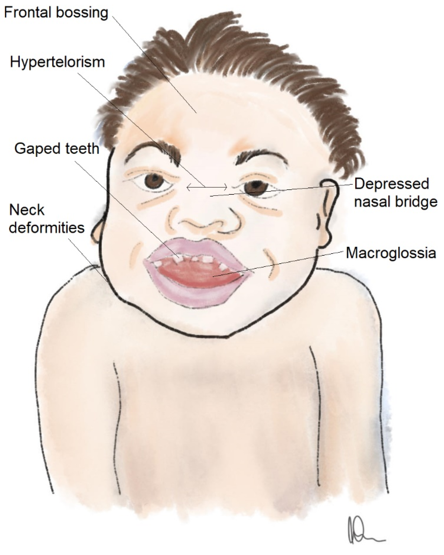 Brainsci 14 01085 g001 Brainsci 14 01085 g001