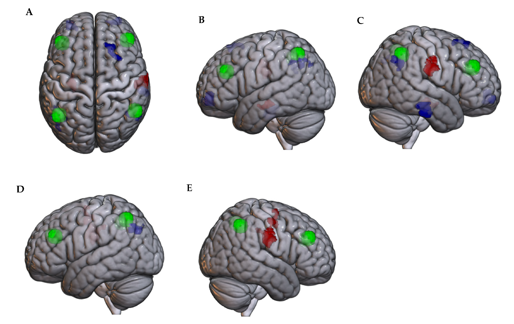 Brainsci 14 01102 g003