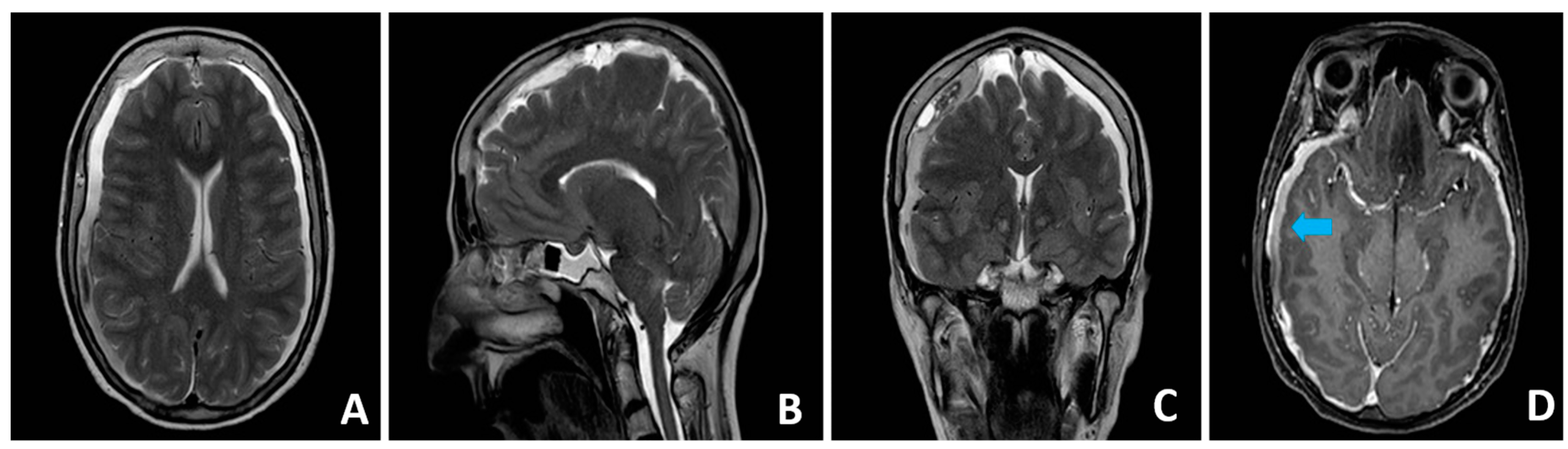 Brainsci 14 01143 g001