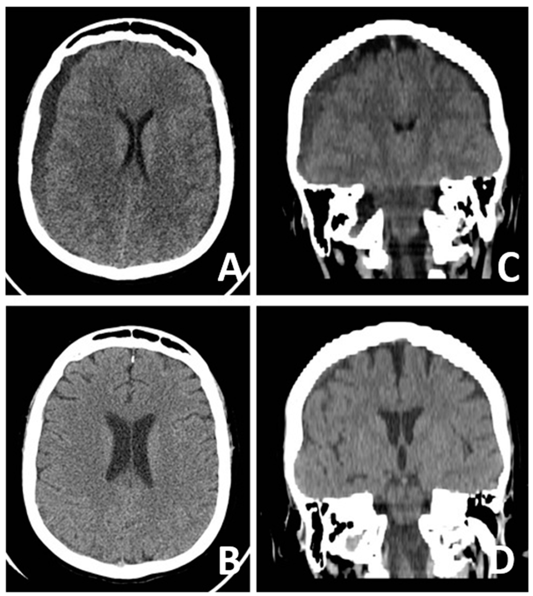 Brainsci 14 01143 g003