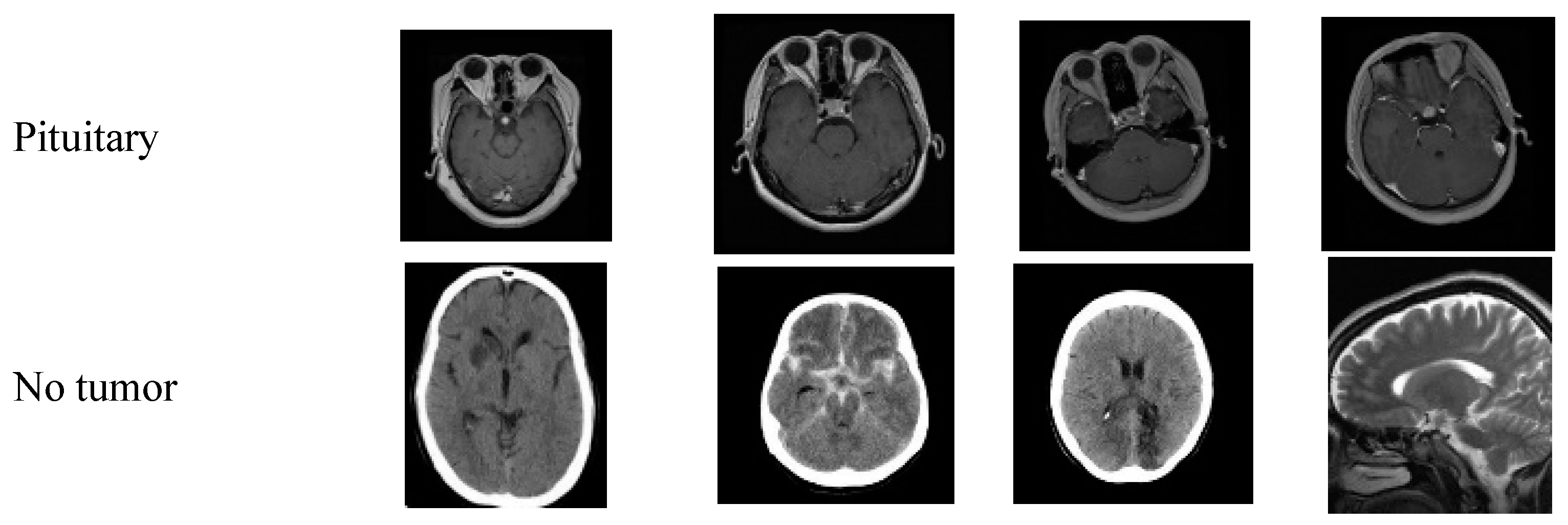 Brainsci 14 01178 g004b