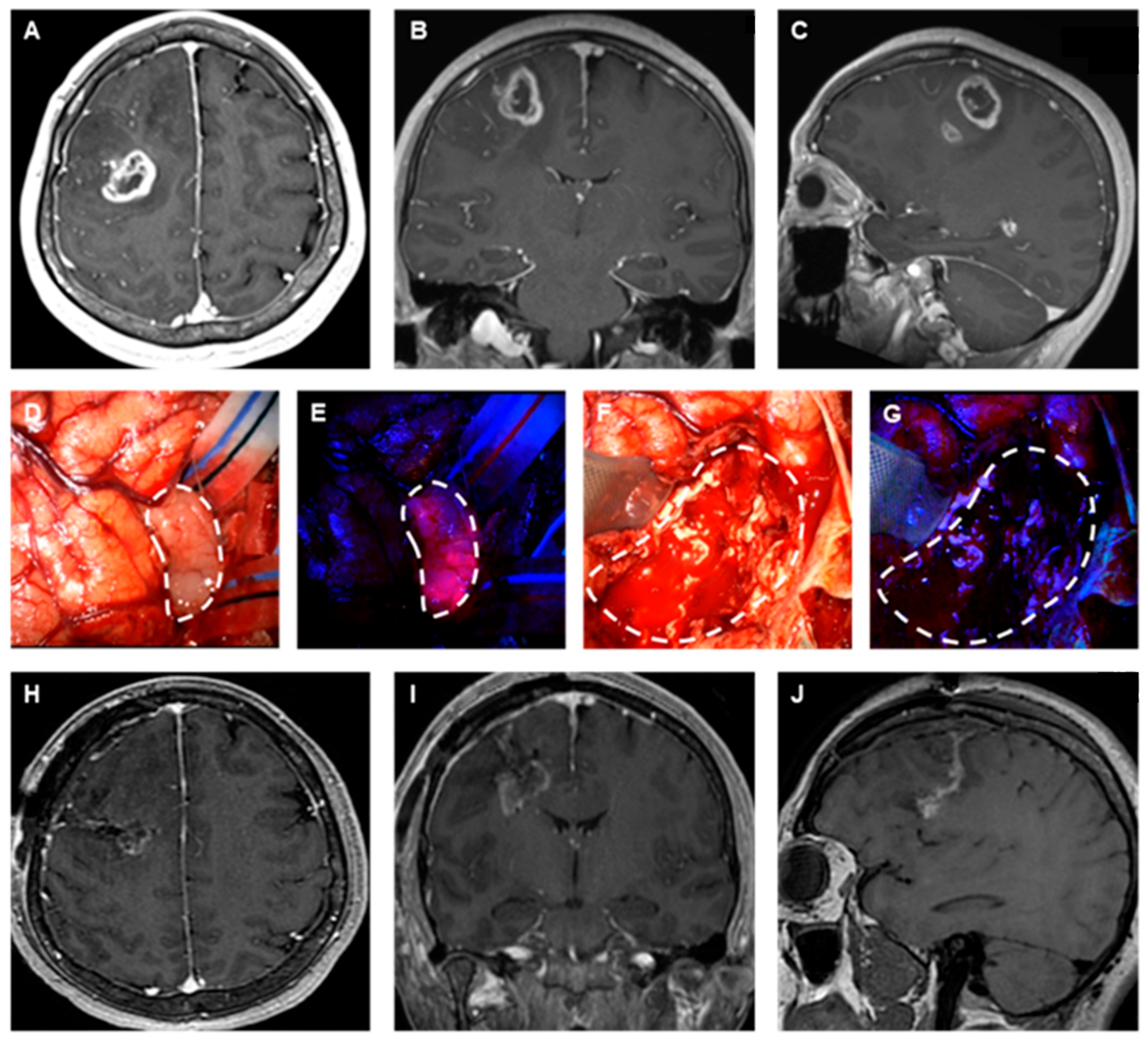 Brainsci 14 01253 g002 Brainsci 14 01253 g002