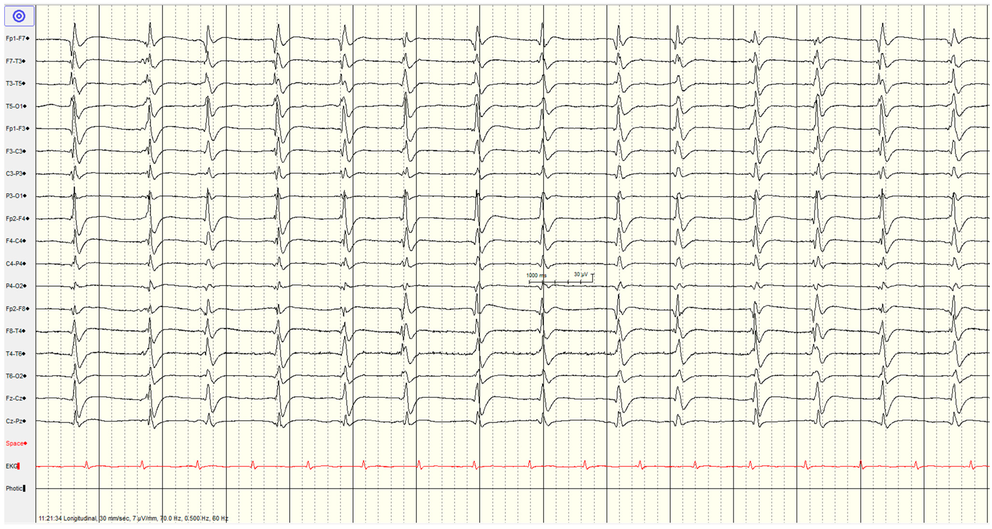 Brainsci 14 01264 g002 Brainsci 14 01264 g002