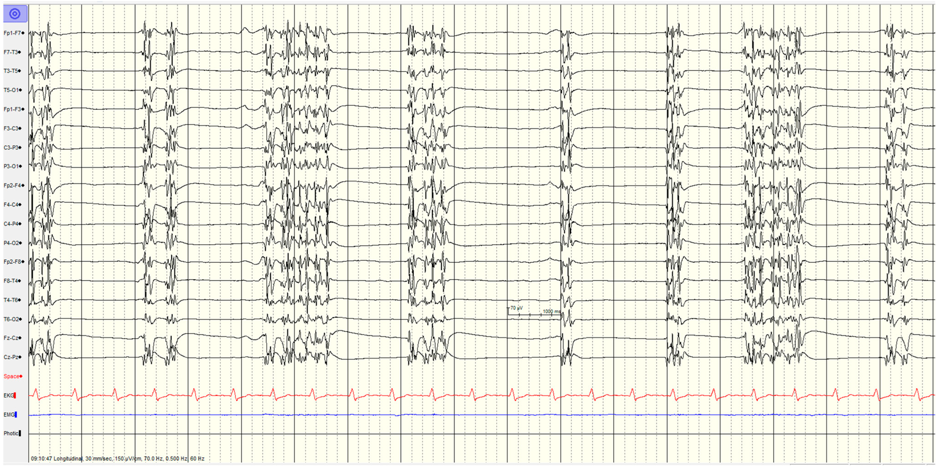 Brainsci 14 01264 g003 Brainsci 14 01264 g003