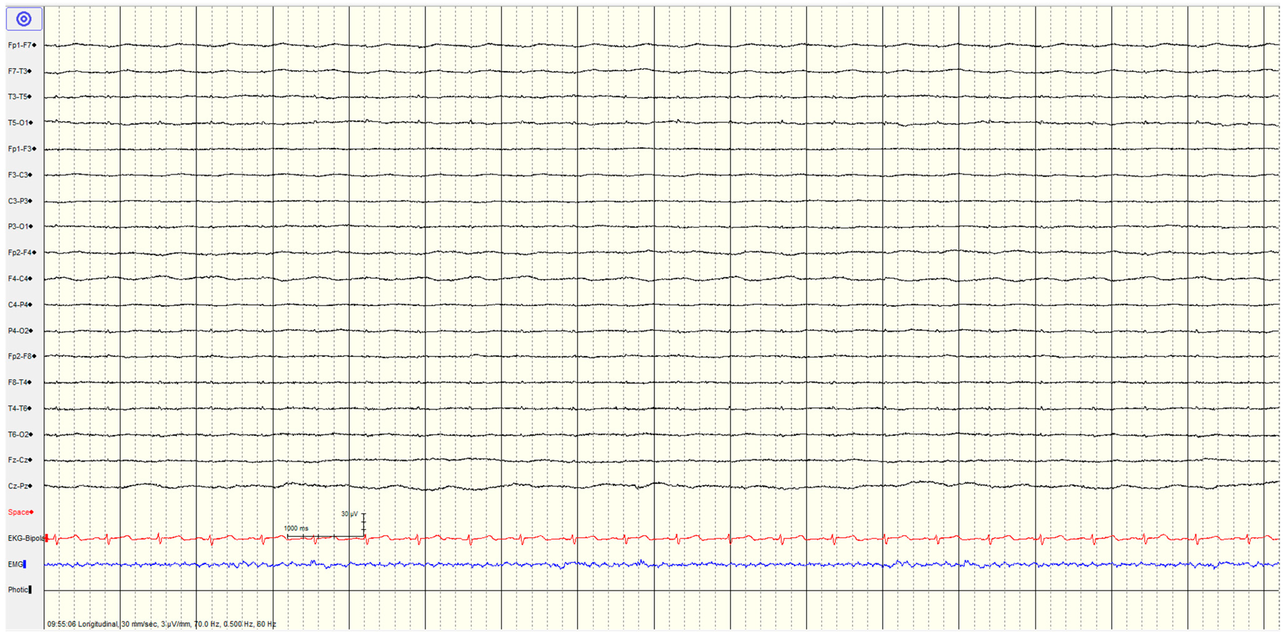 Brainsci 14 01264 g004 Brainsci 14 01264 g004