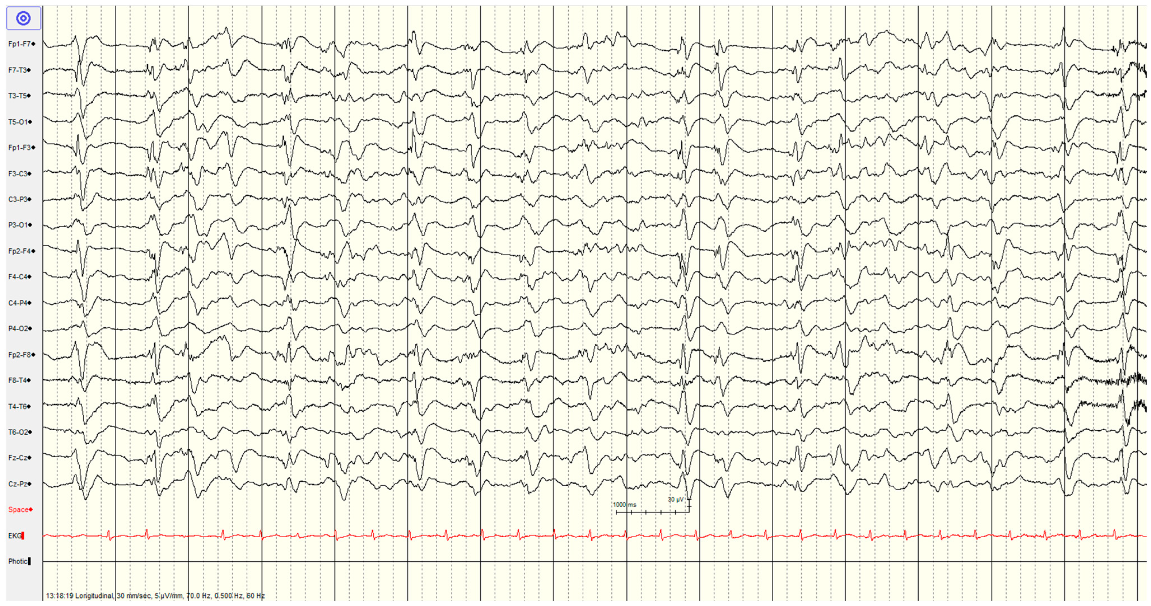Brainsci 14 01264 g005 Brainsci 14 01264 g005