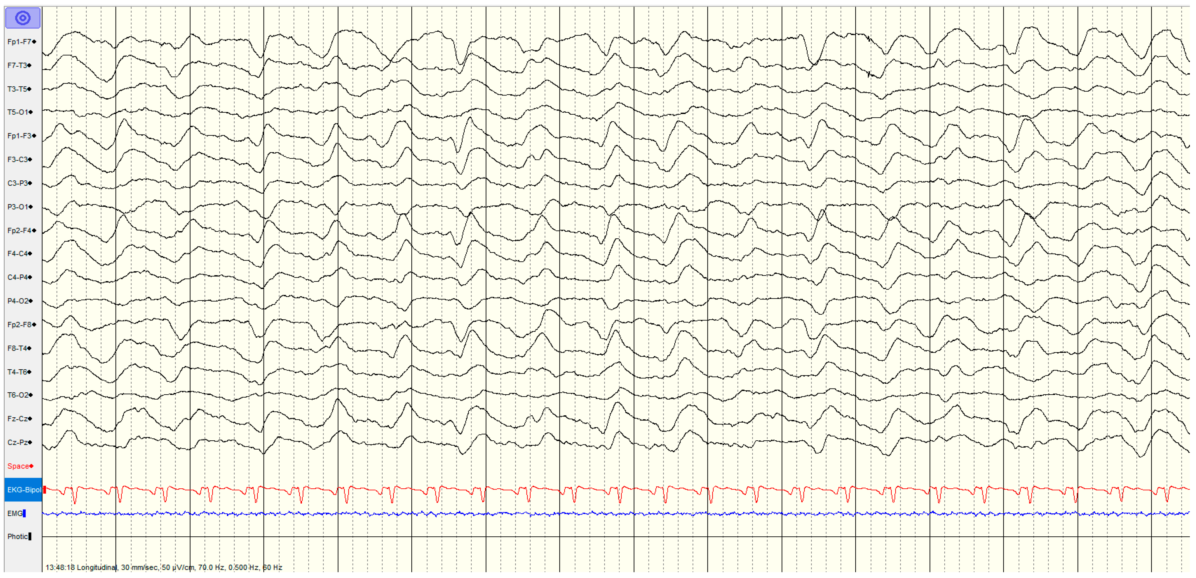 Brainsci 14 01264 g006 Brainsci 14 01264 g006