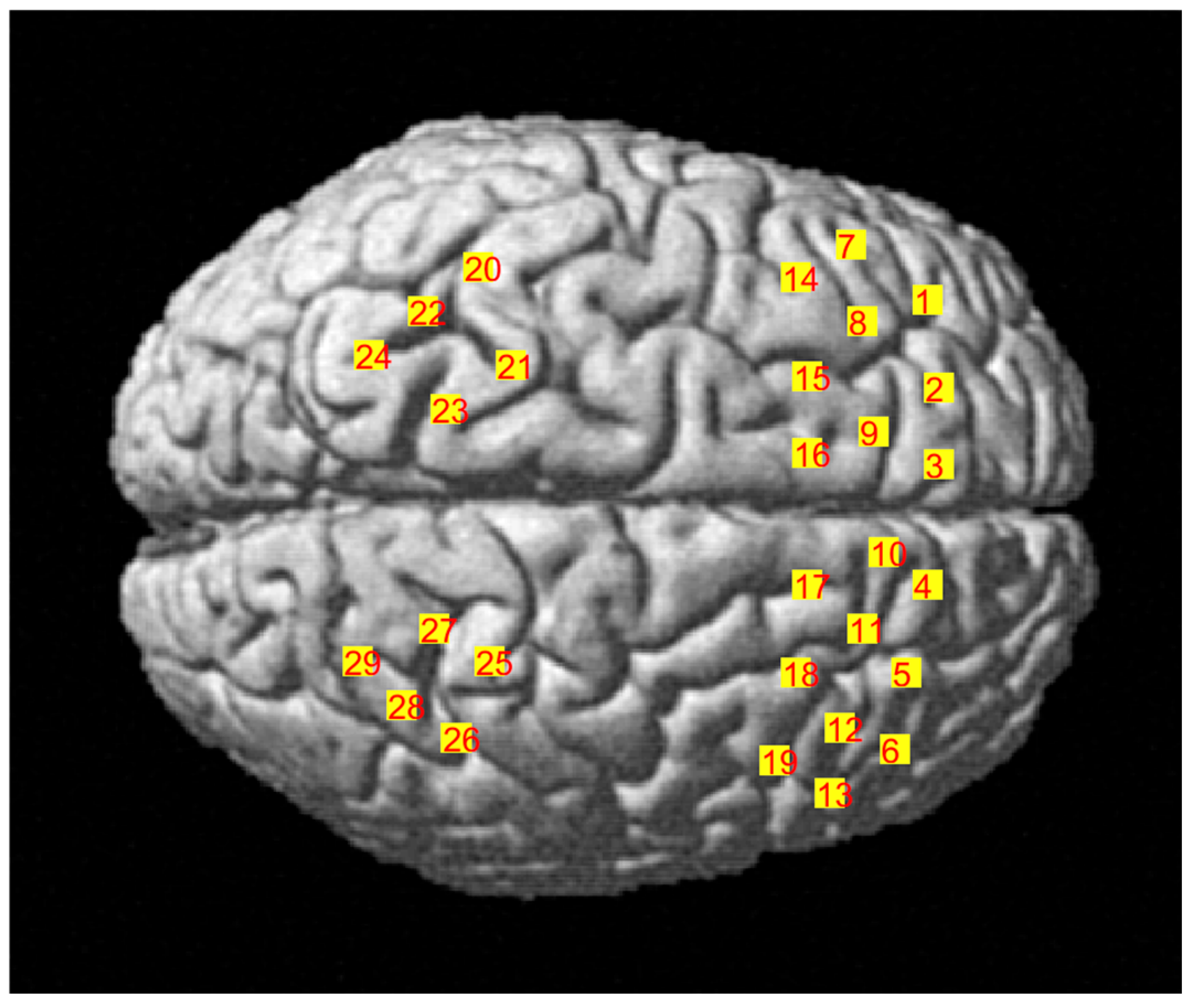 Brainsci 15 00008 g003