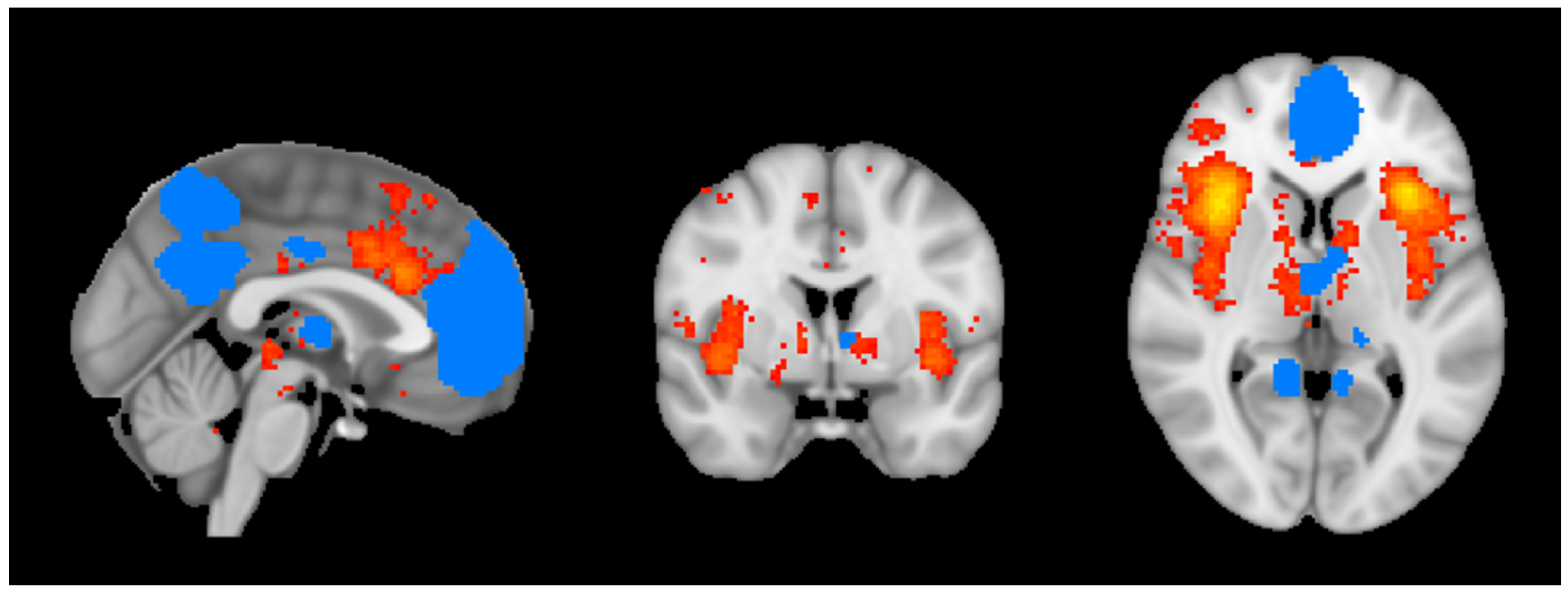 Brainsci 15 00037 g001 Brainsci 15 00037 g001
