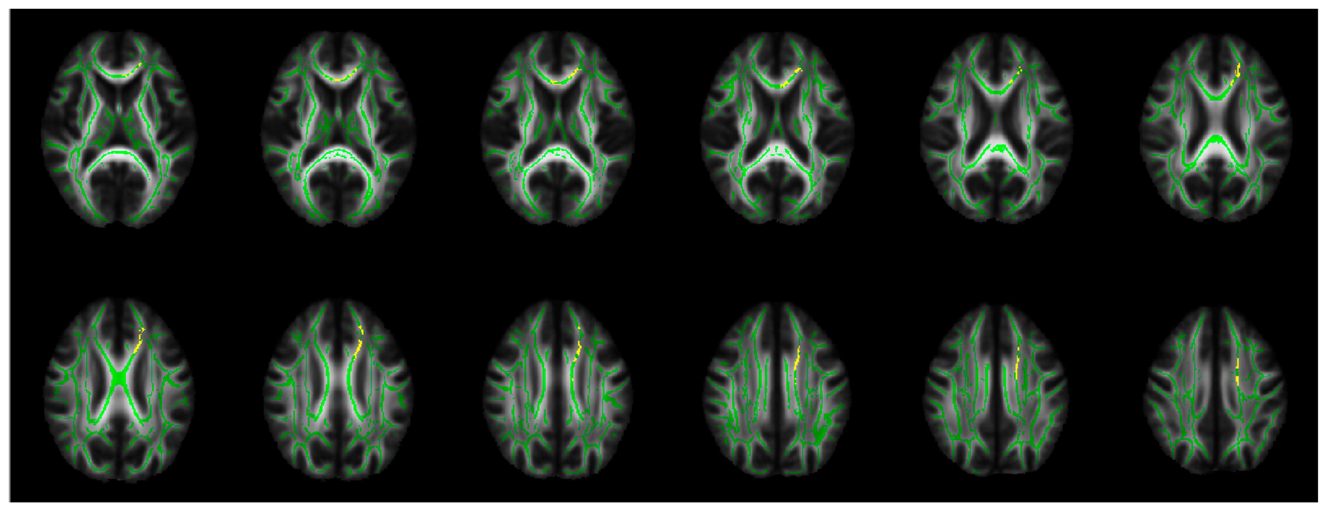 Brainsci 15 00108 g002 Brainsci 15 00108 g002