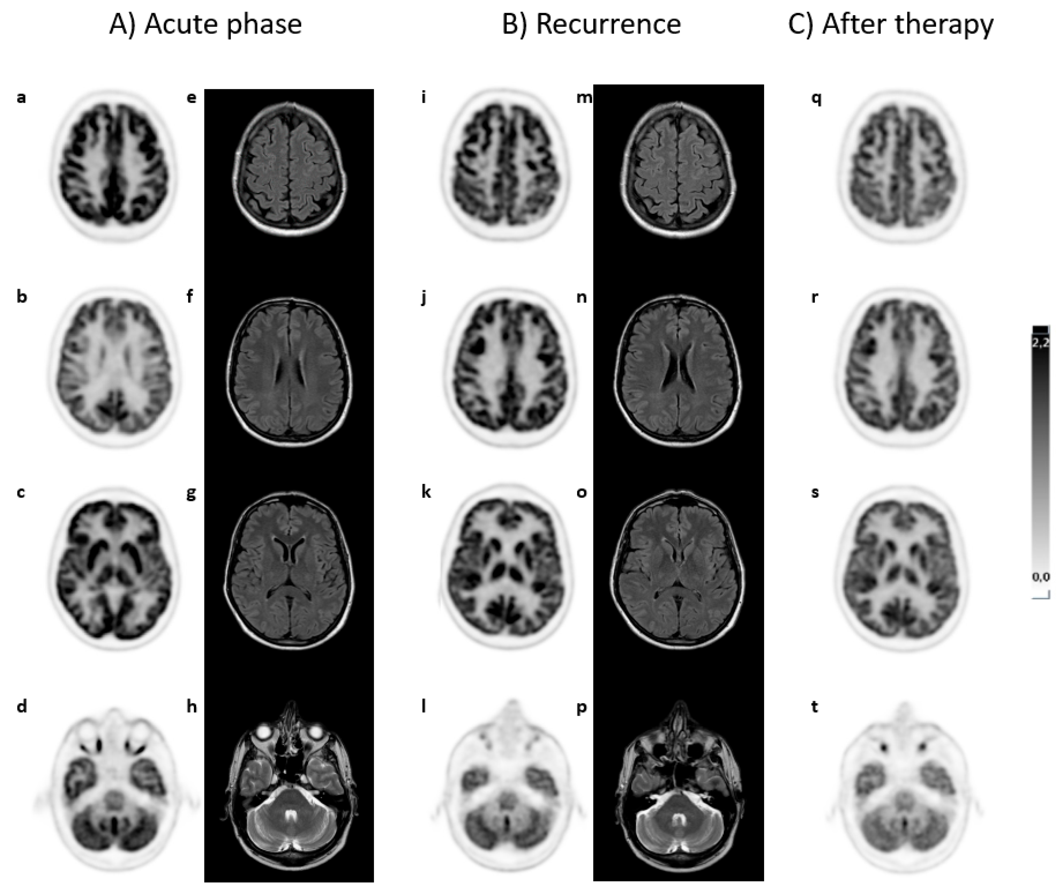 Brainsci 15 00113 g001