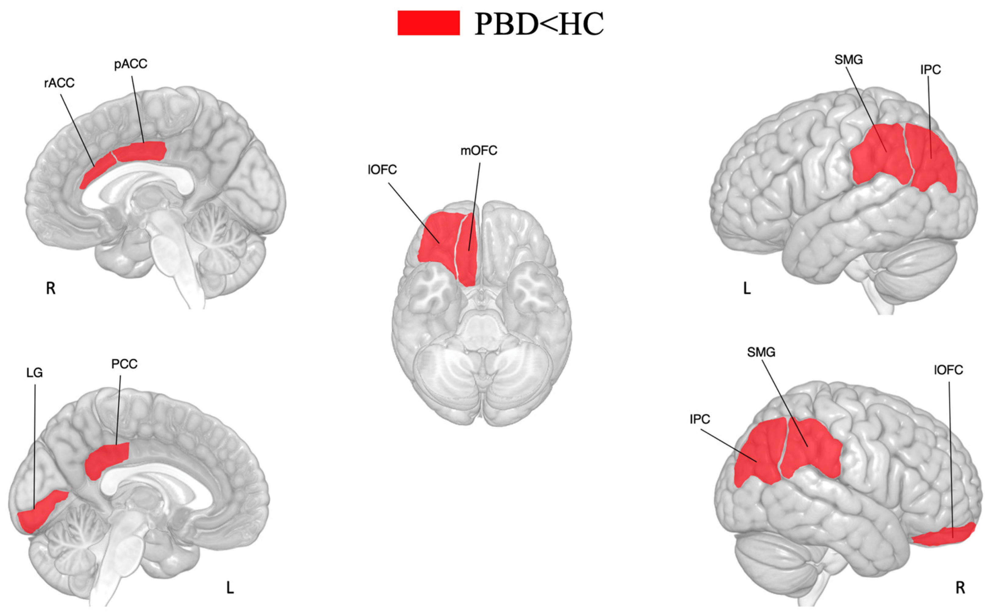 Brainsci 15 00152 g002 Brainsci 15 00152 g002