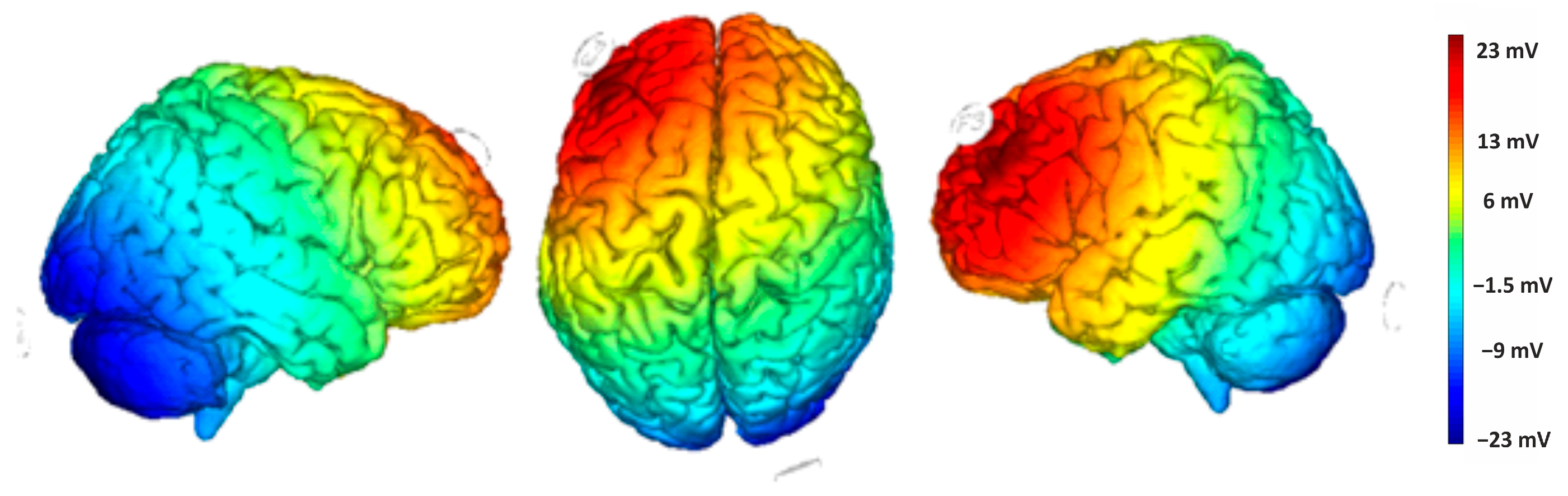 Brainsci 15 00176 g003