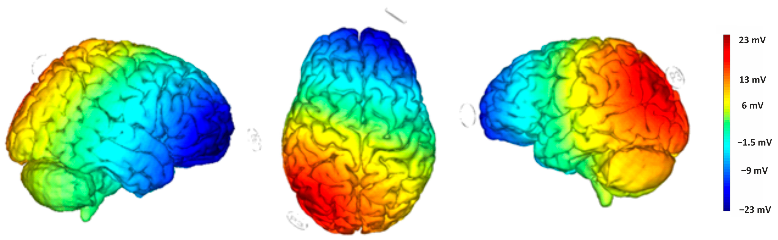Brainsci 15 00176 g005