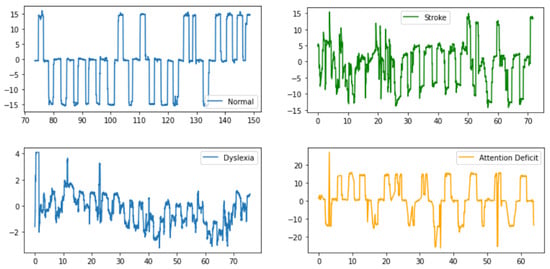 Brainsci 15 00230 g0a3