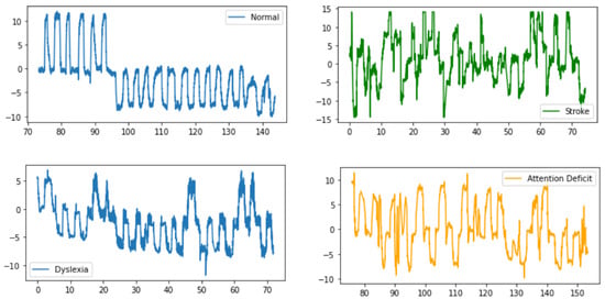 Brainsci 15 00230 g0a4