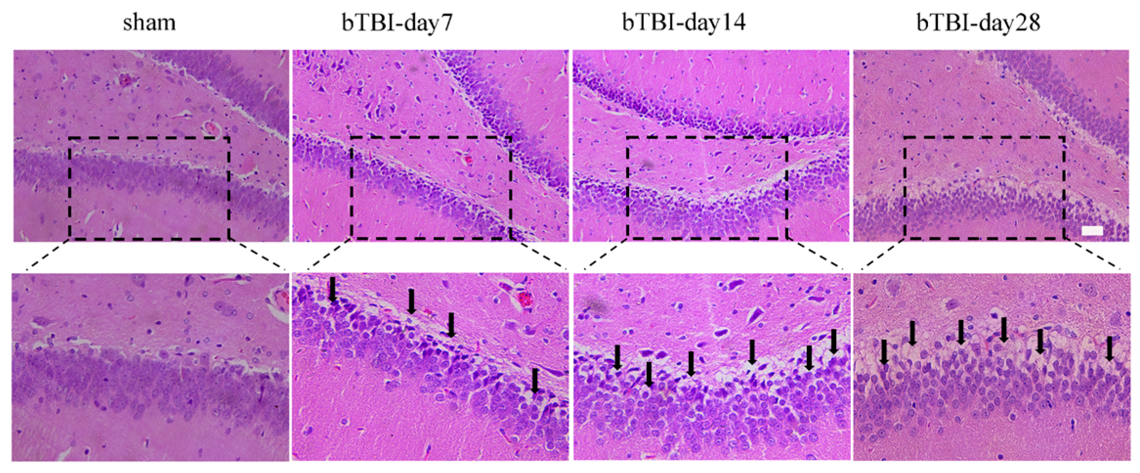 Brainsci 15 00236 g002