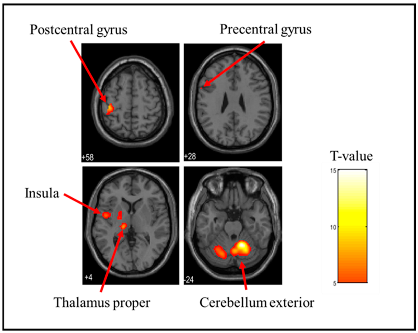 Brainsci 15 00264 g003 Brainsci 15 00264 g003