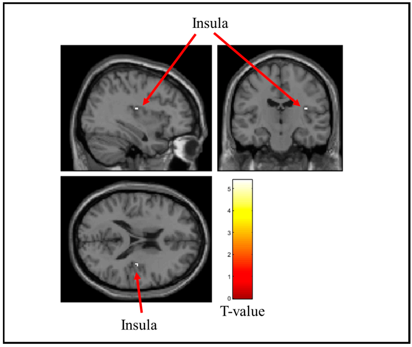 Brainsci 15 00264 g007 Brainsci 15 00264 g007