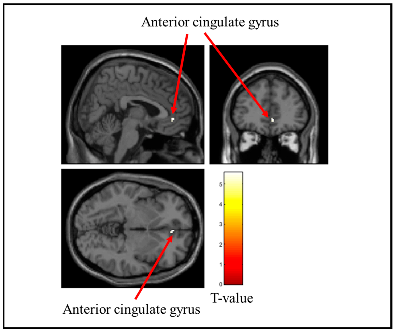 Brainsci 15 00264 g008 Brainsci 15 00264 g008