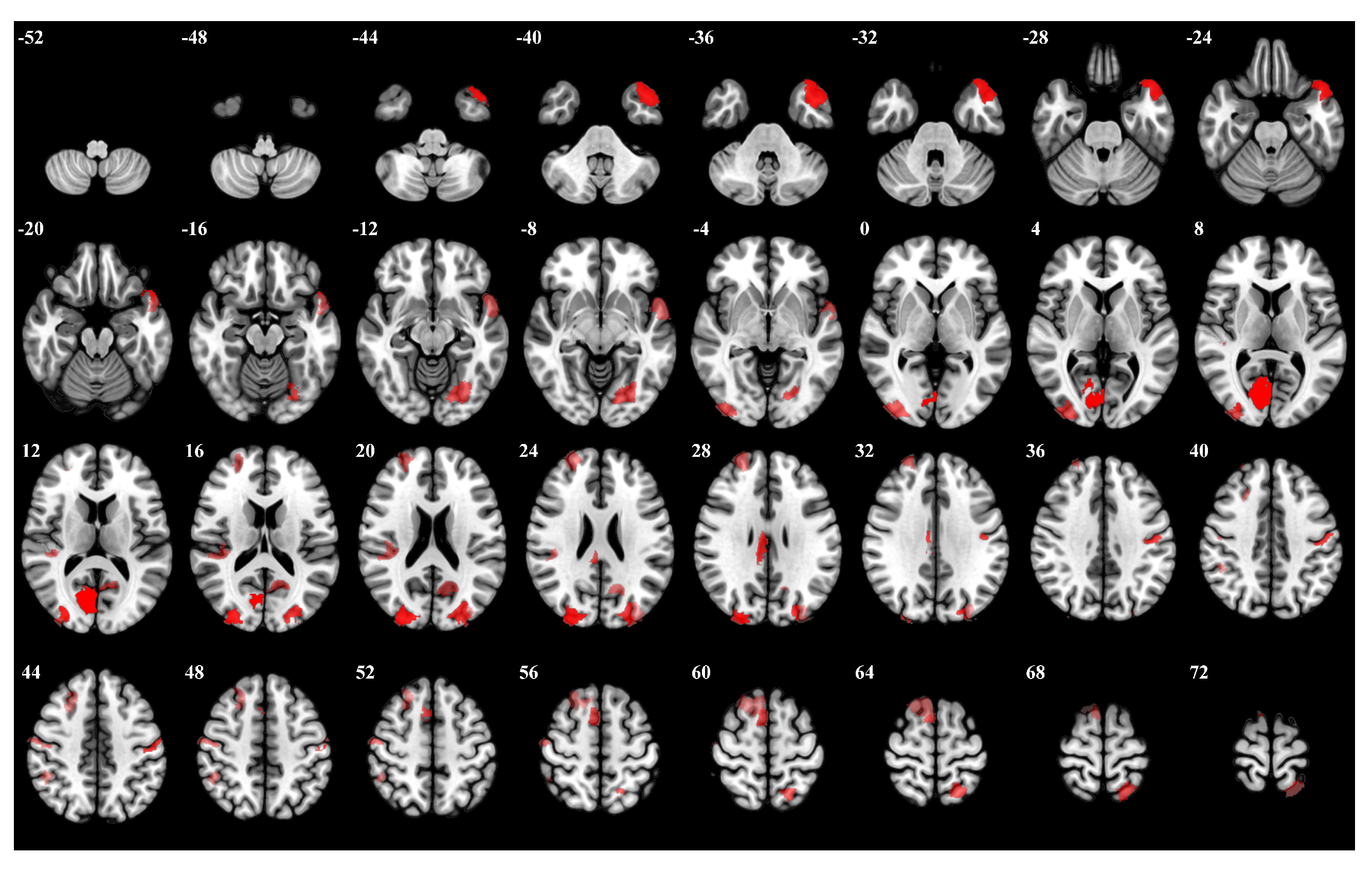 Brainsci 15 00277 g005