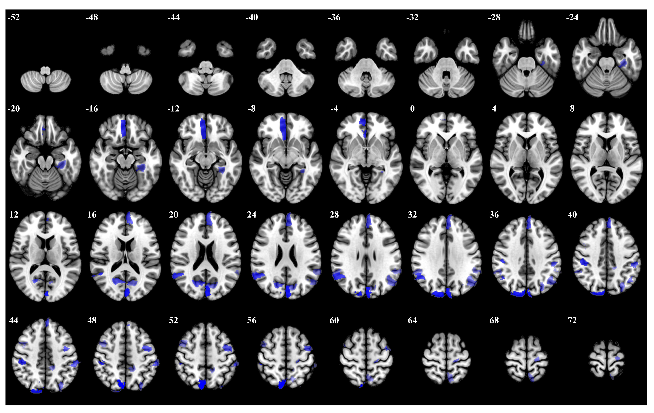 Brainsci 15 00277 g007