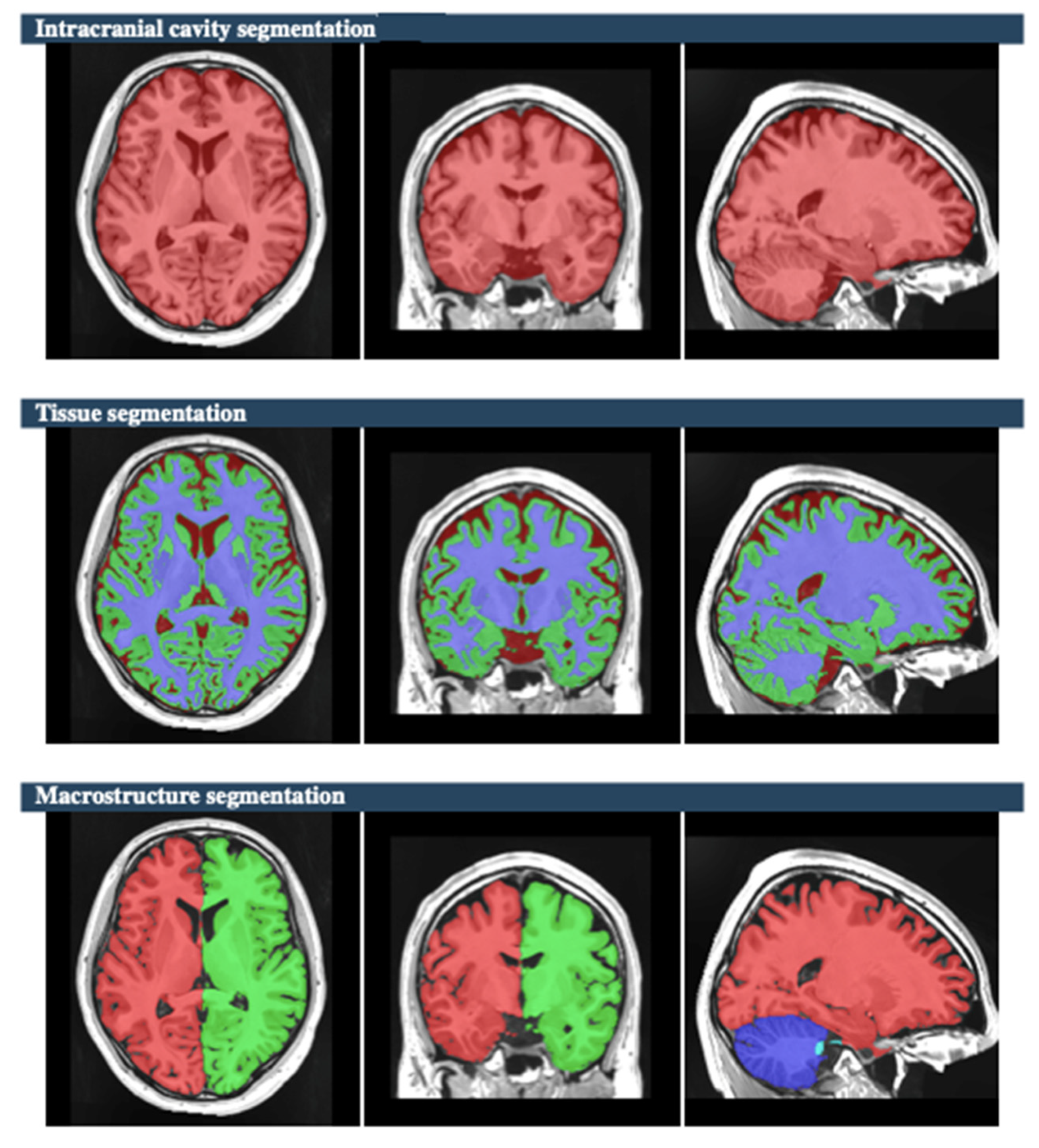 Brainsci 15 00295 g001 Brainsci 15 00295 g001